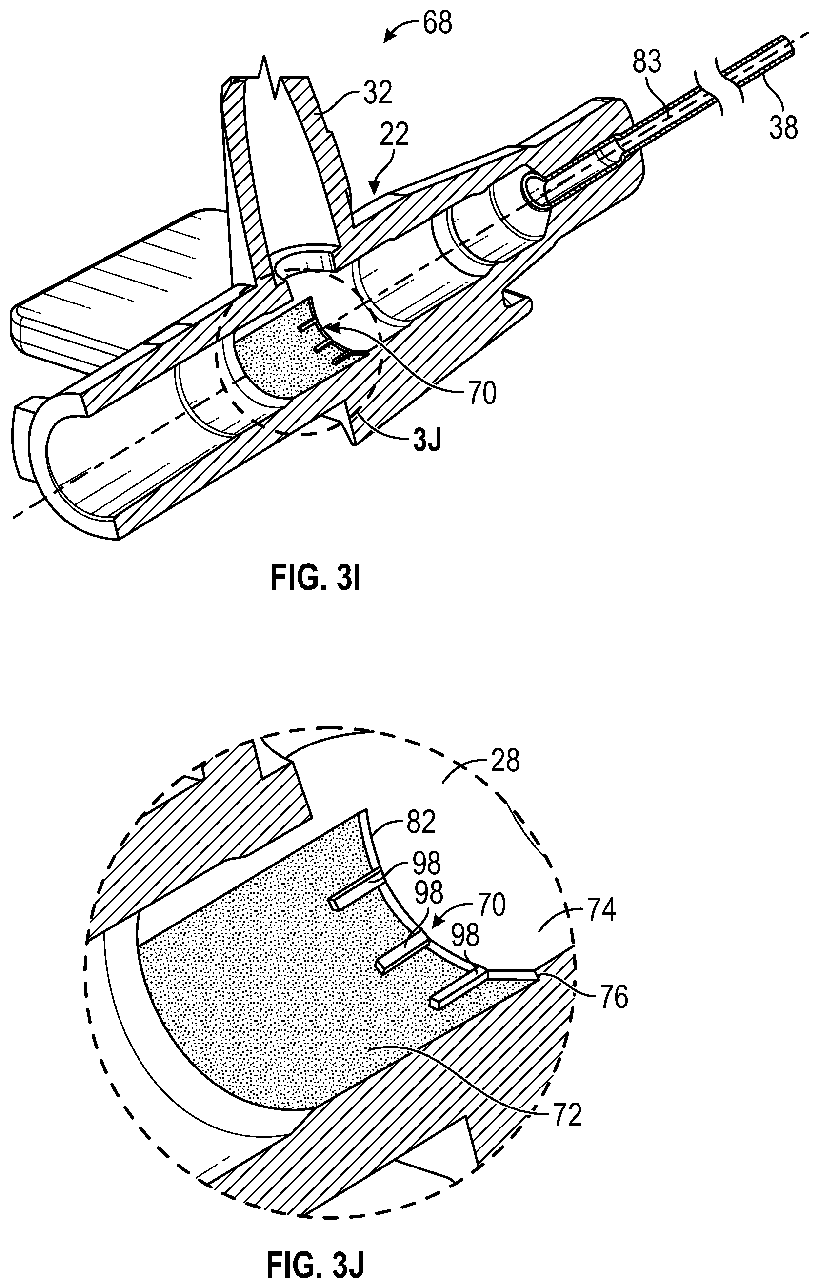 Patent US12611533 Figure 8 – Annular valve securement within a catheter assembly