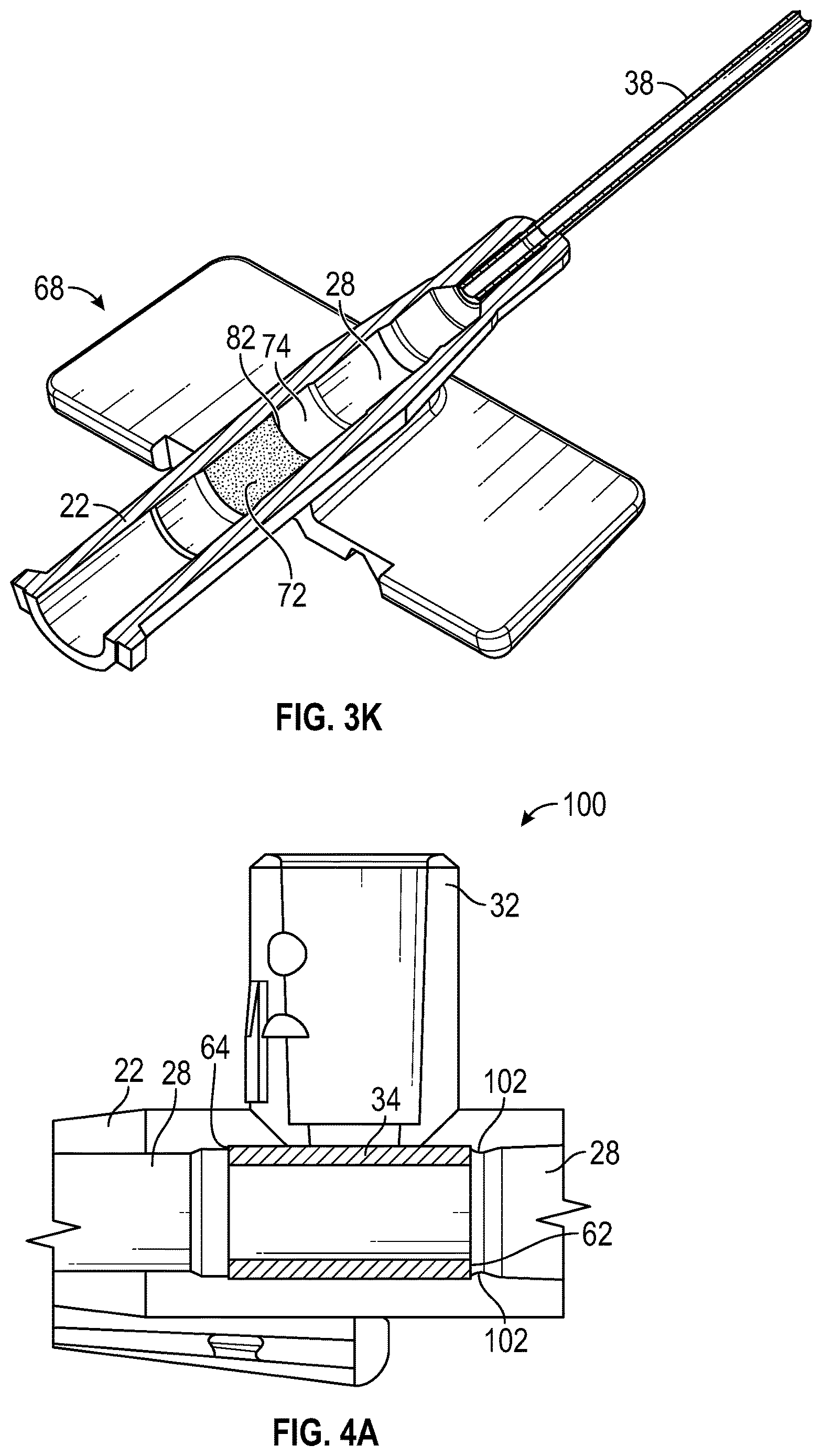 Patent US12611533 Figure 9 – Annular valve securement within a catheter assembly
