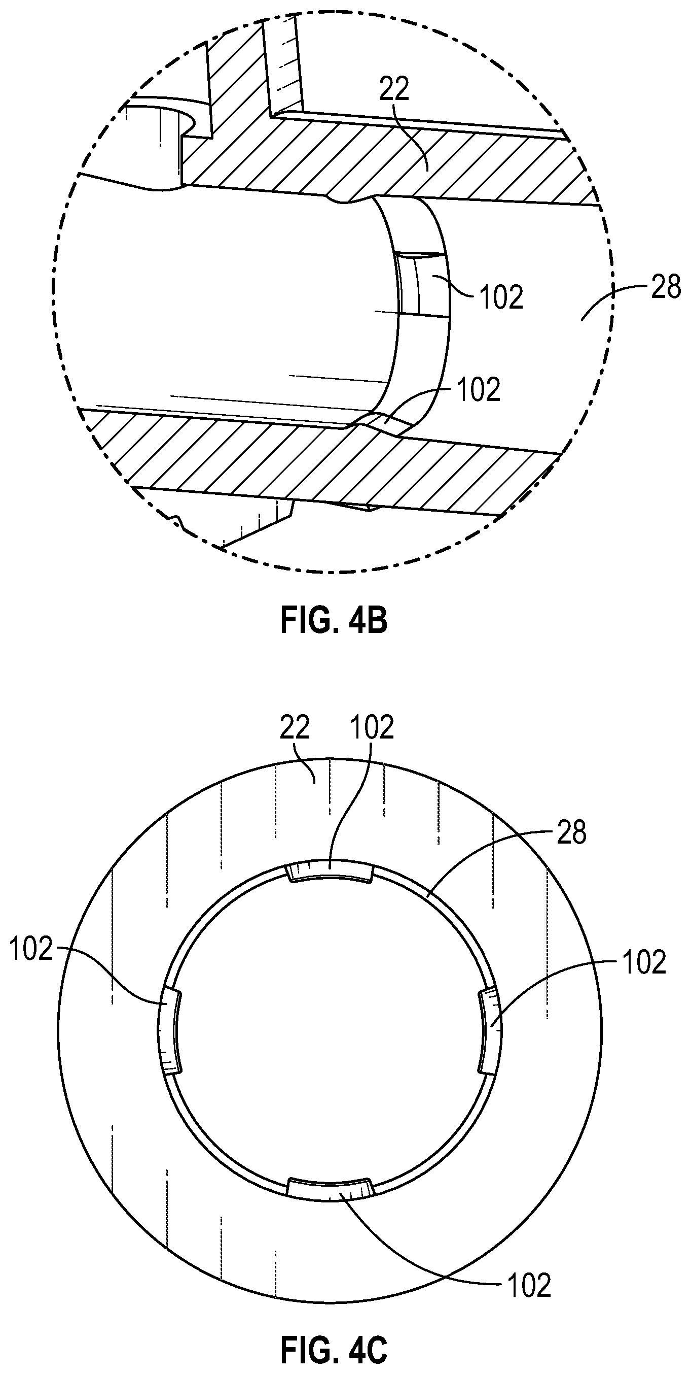 Patent US12611533 Figure 10 – Annular valve securement within a catheter assembly