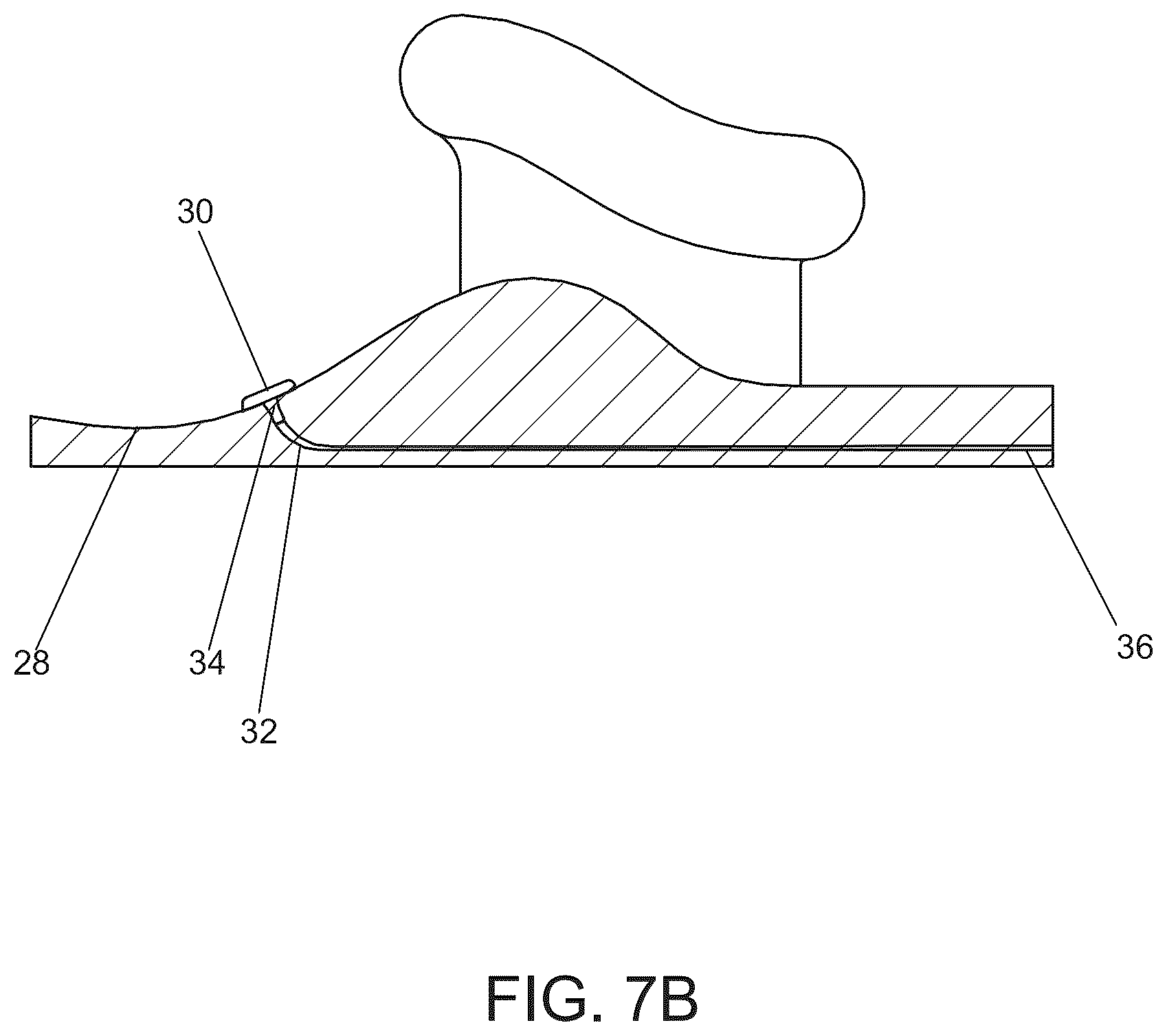 Patent US12611538 Figure 14 – Electrode interface devices for delivery of neuroregenerative therapy