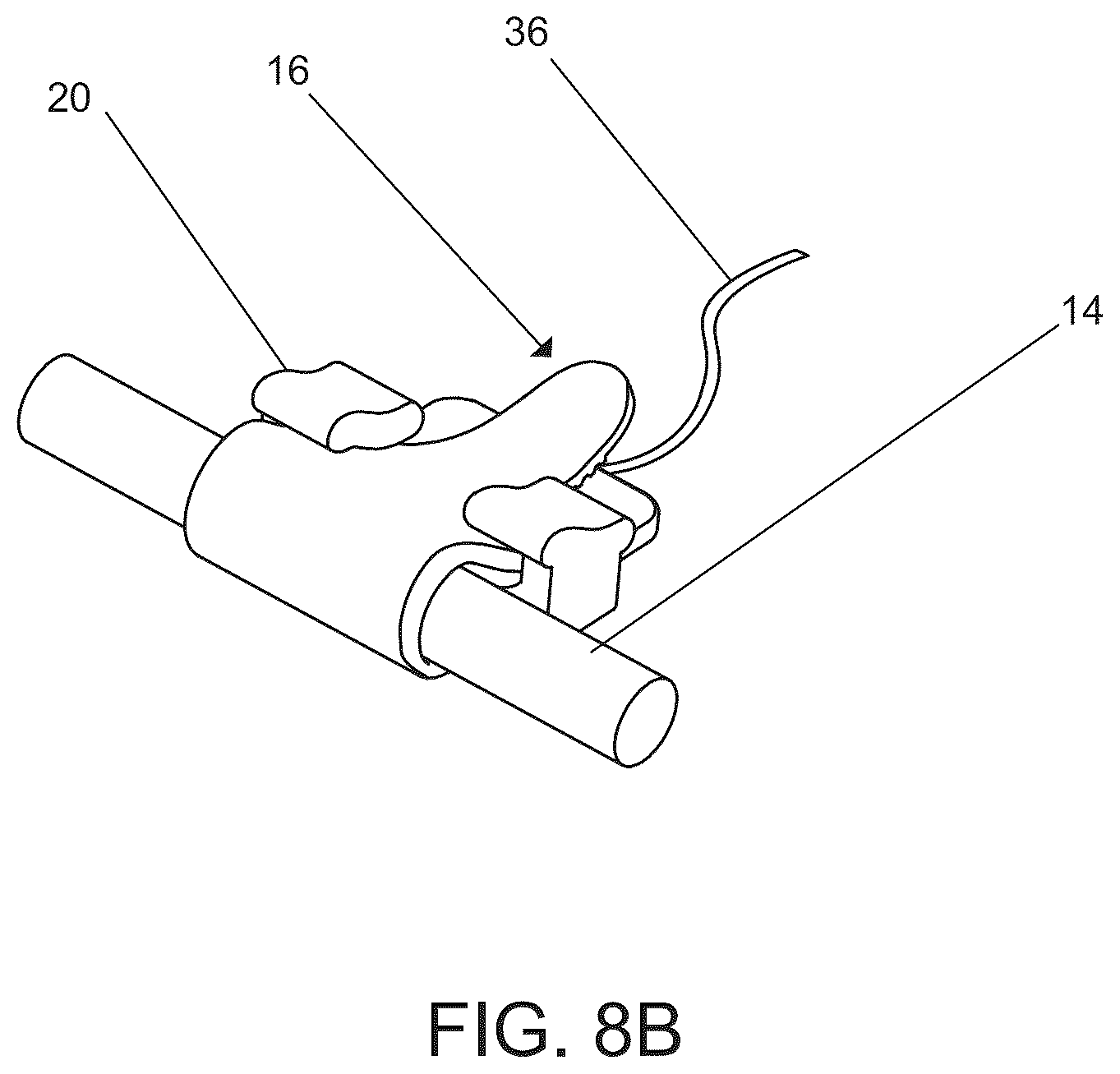 Patent US12611538 Figure 16 – Electrode interface devices for delivery of neuroregenerative therapy