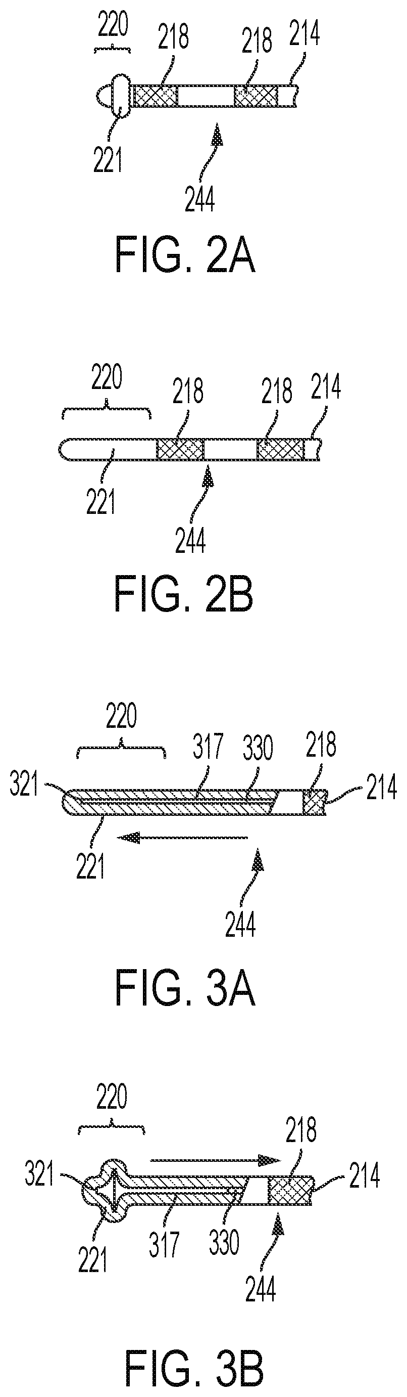 Patent US12611539 Figure 2 – Medical device lead tip anchor