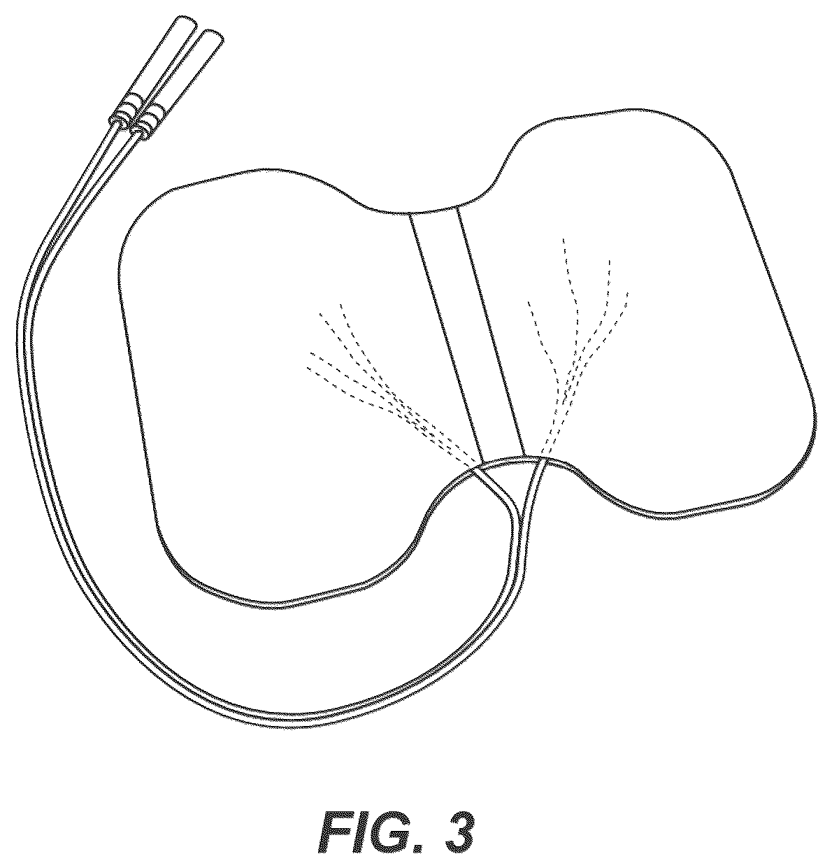 Patent US12611540 Figure 2 – Modulation of growth differentiation factor 10 (GDF10)