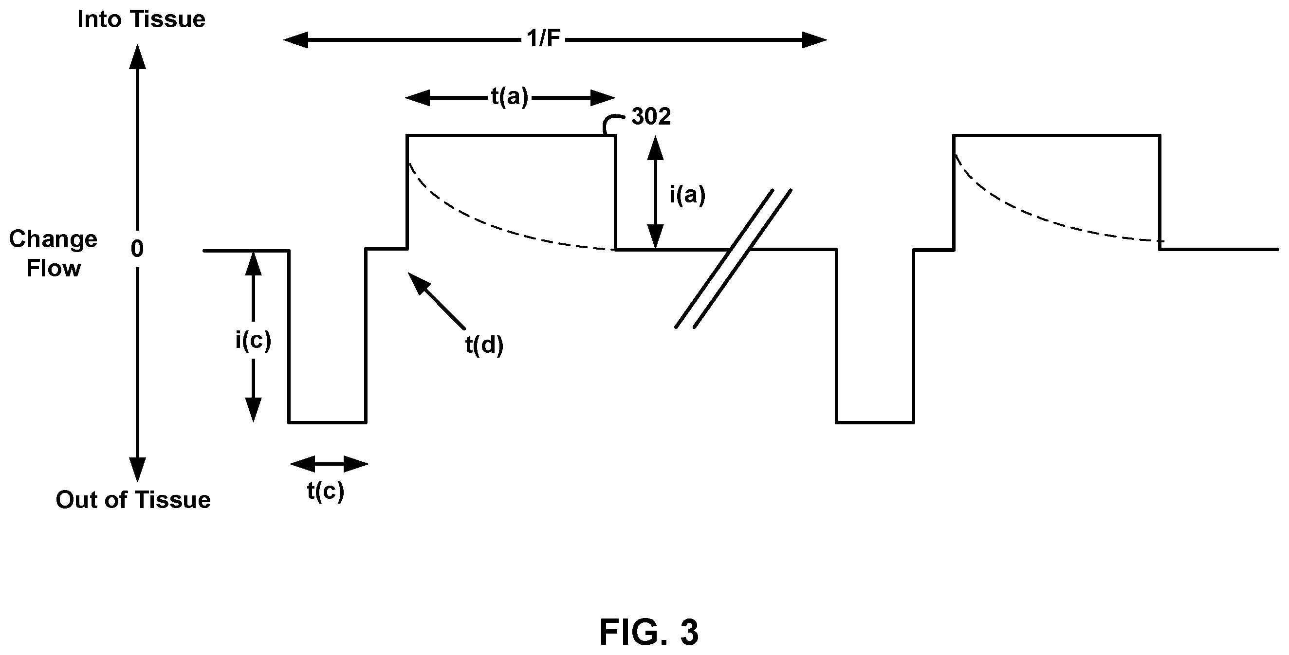 Patent US12611542 Figure 3 – Directional activation with electrical stimulation