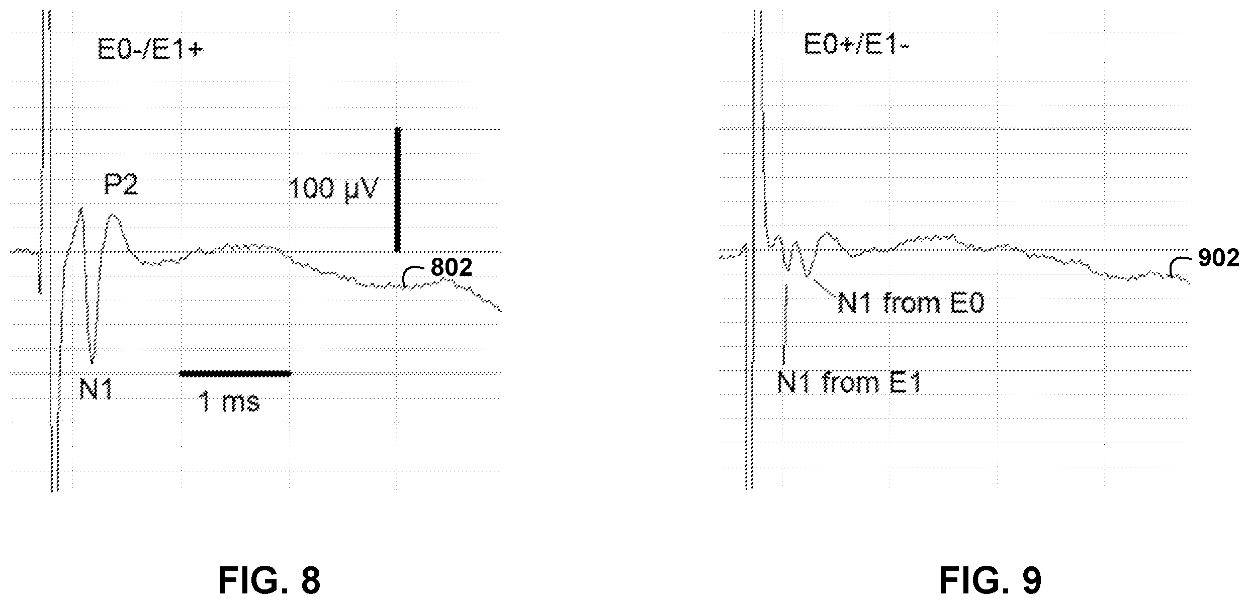 Patent US12611542 Figure 11 – Directional activation with electrical stimulation
