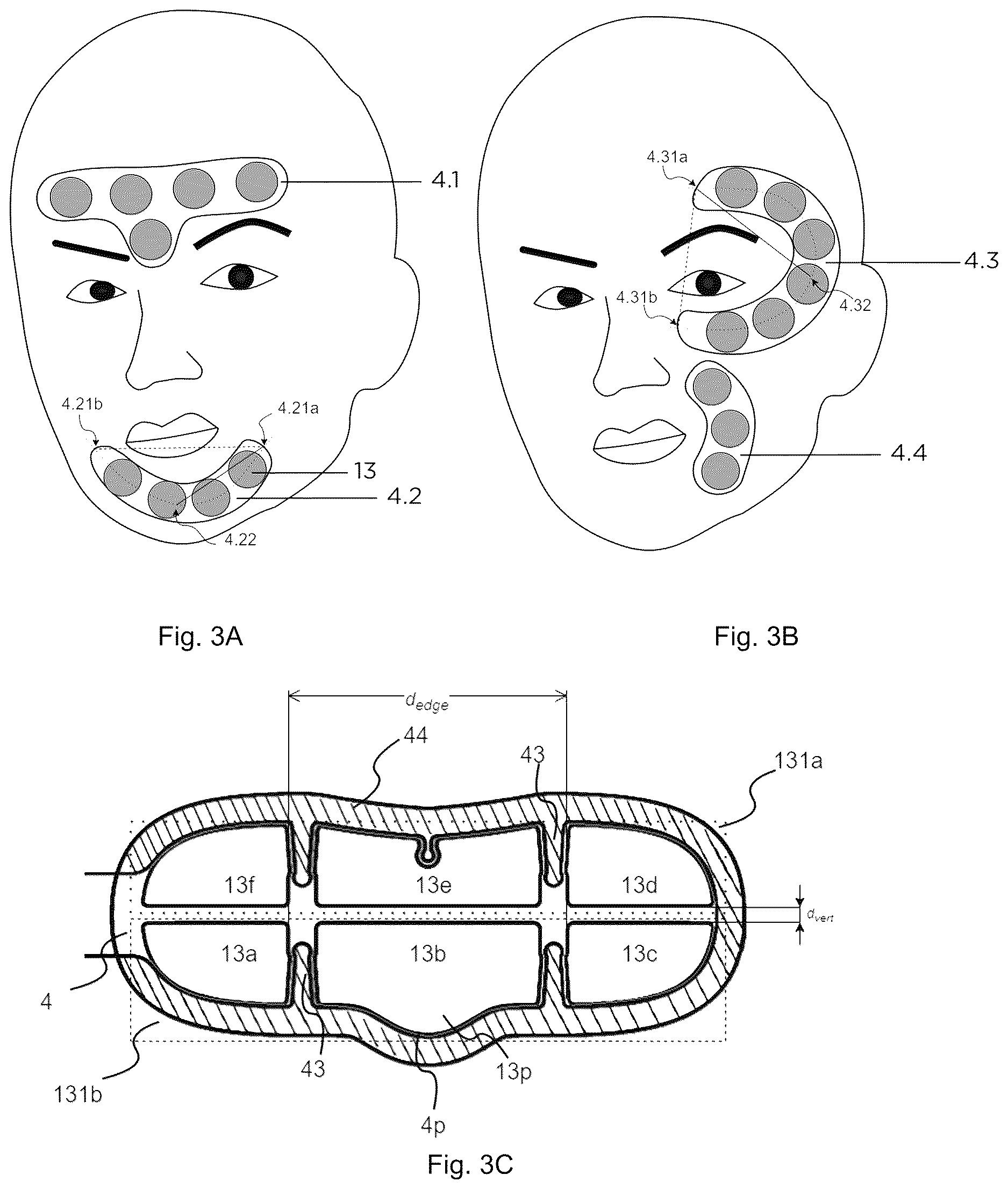 Patent US12611545 Figure 3 – Device and method for unattended treatment of a patient