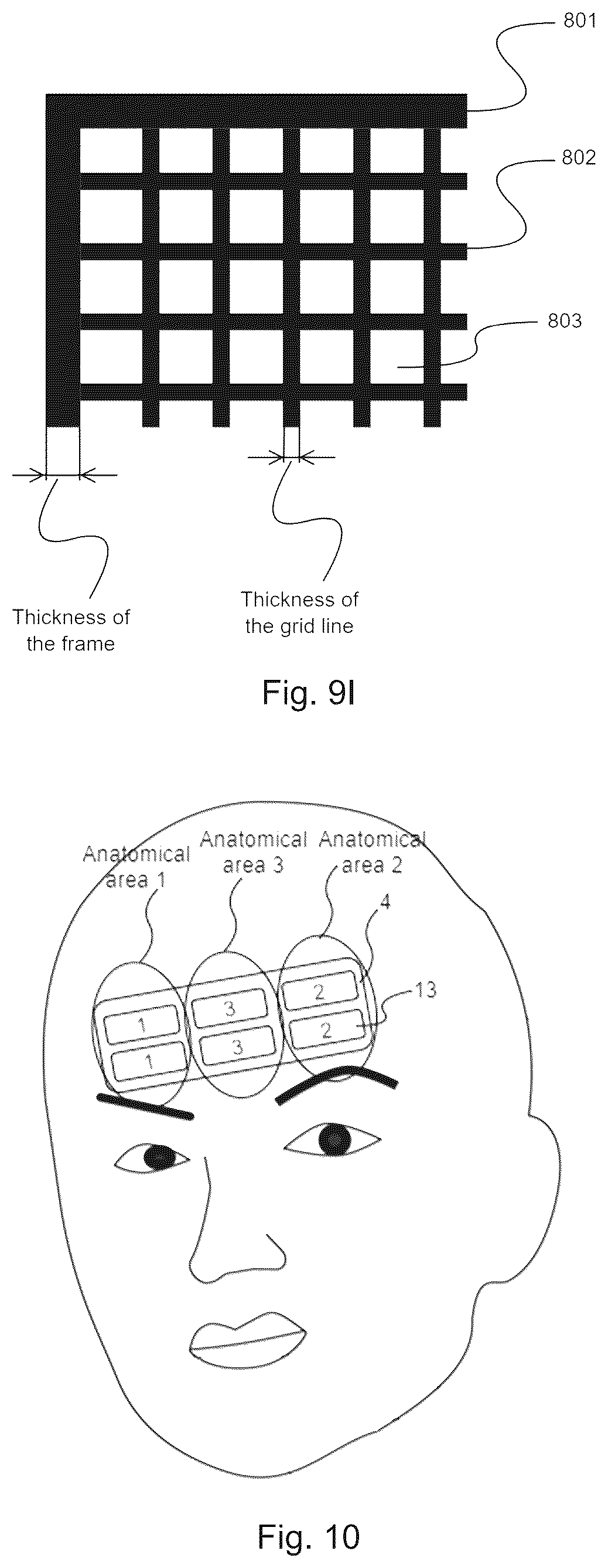 Patent US12611545 Figure 12 – Device and method for unattended treatment of a patient