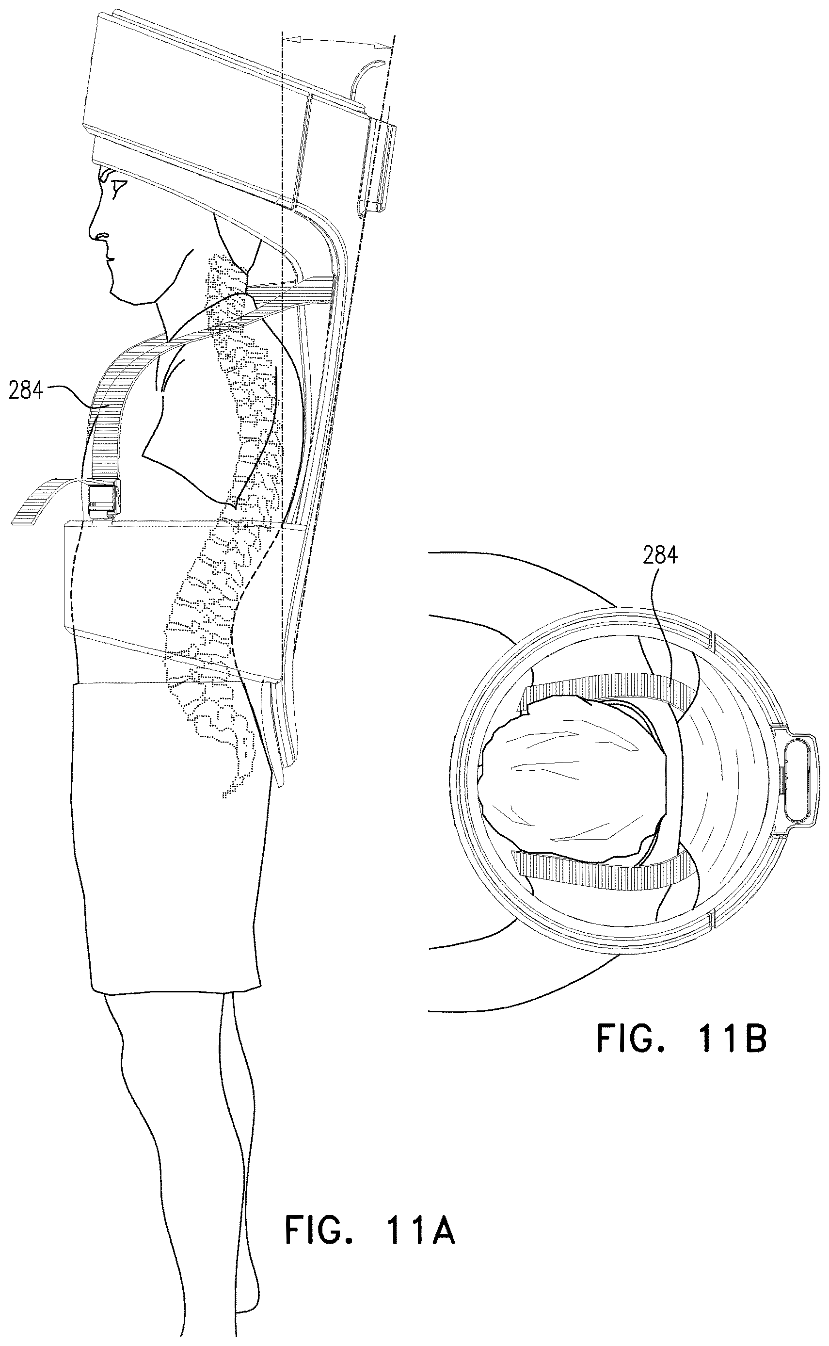 Patent US12611548 Figure 16 – Treatment apparatus, systems and methods
