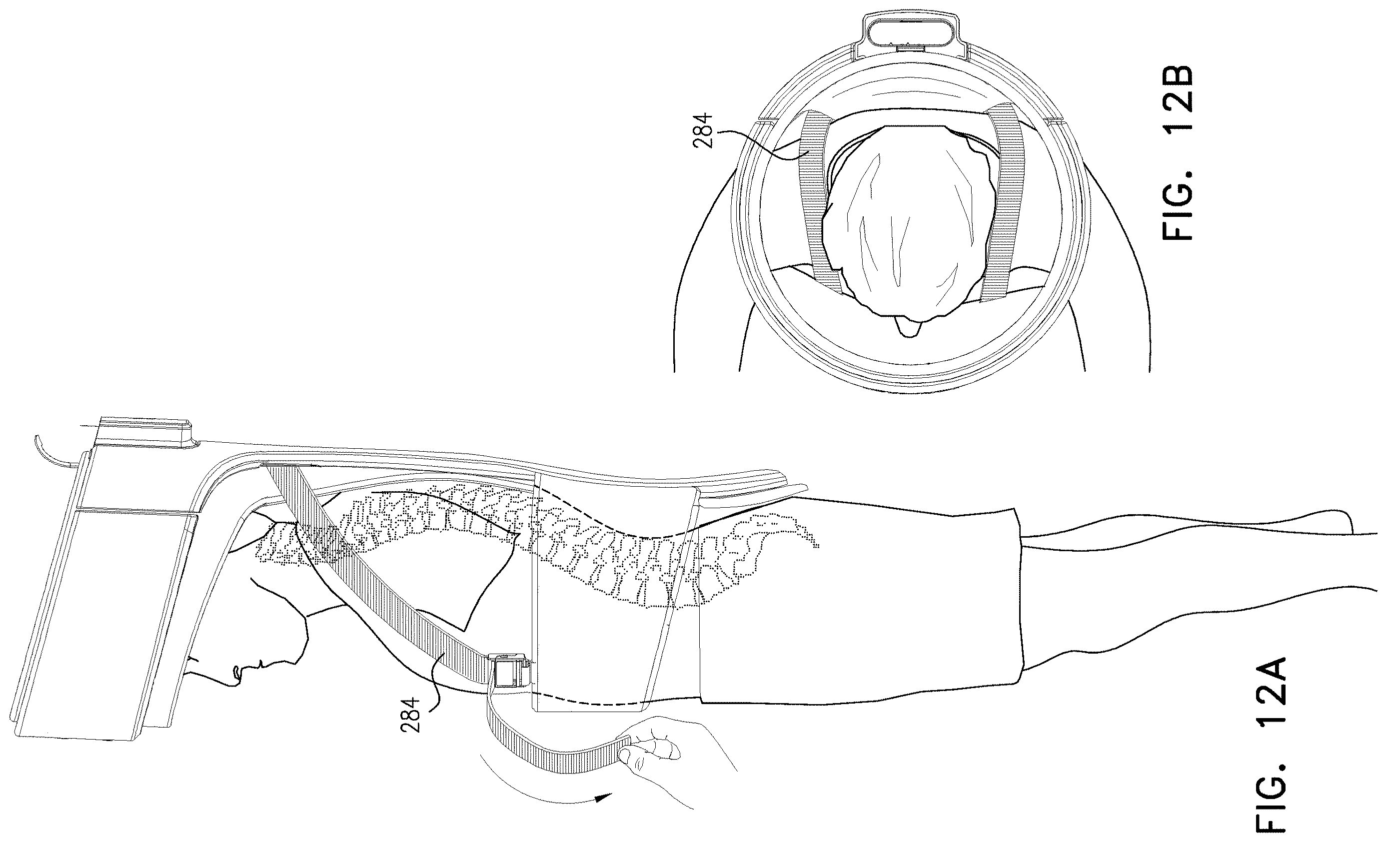 Patent US12611548 Figure 17 – Treatment apparatus, systems and methods