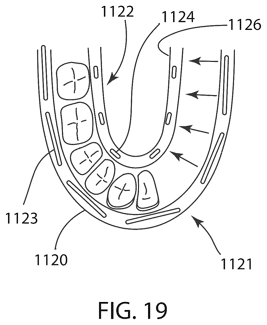 Patent US12611550 Figure 13 – Intra-oral light therapy apparatuses and methods for their use