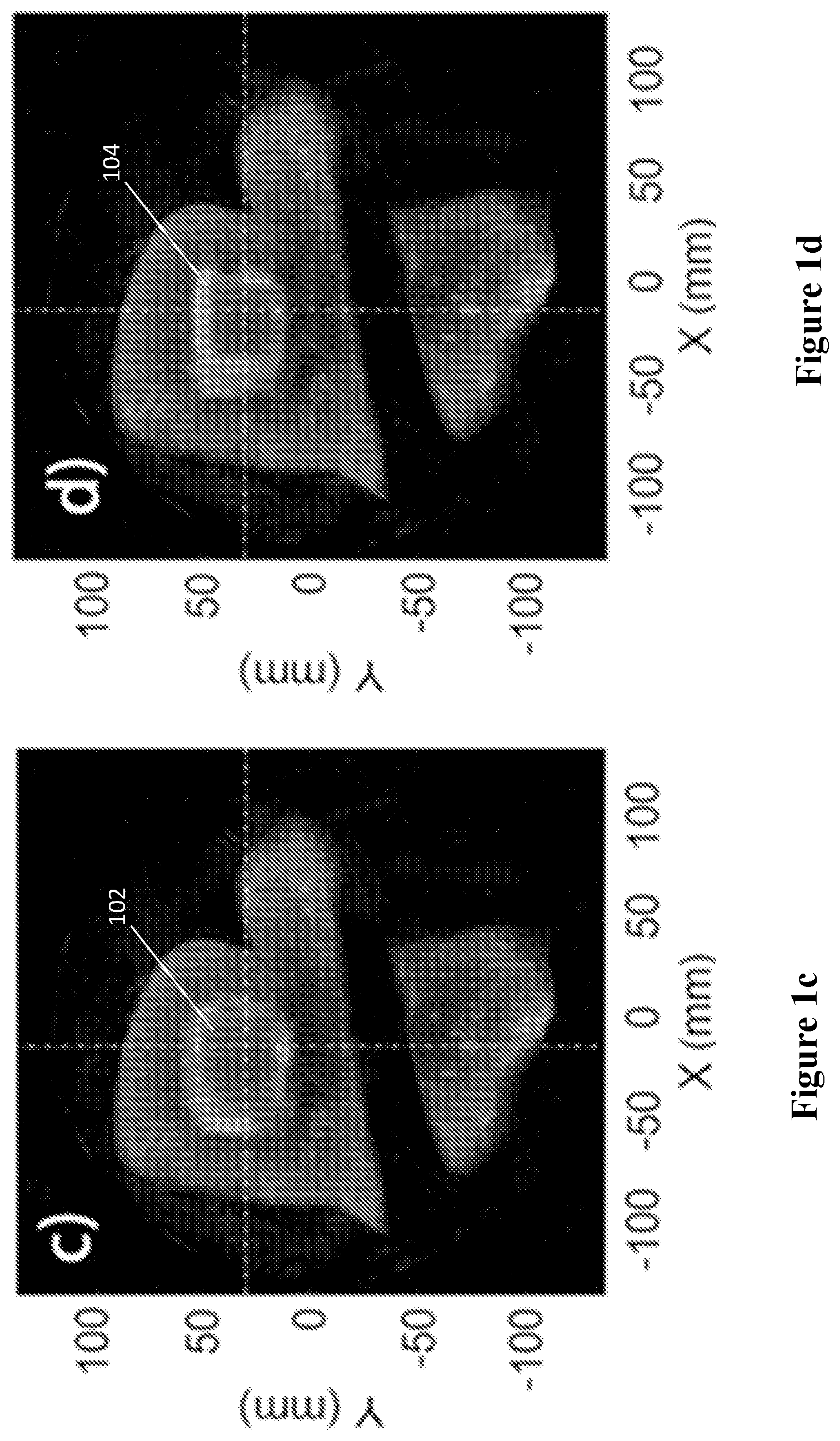 Patent US12611553 Figure 2 – System and method of XACT/US-guided radiotherapy
