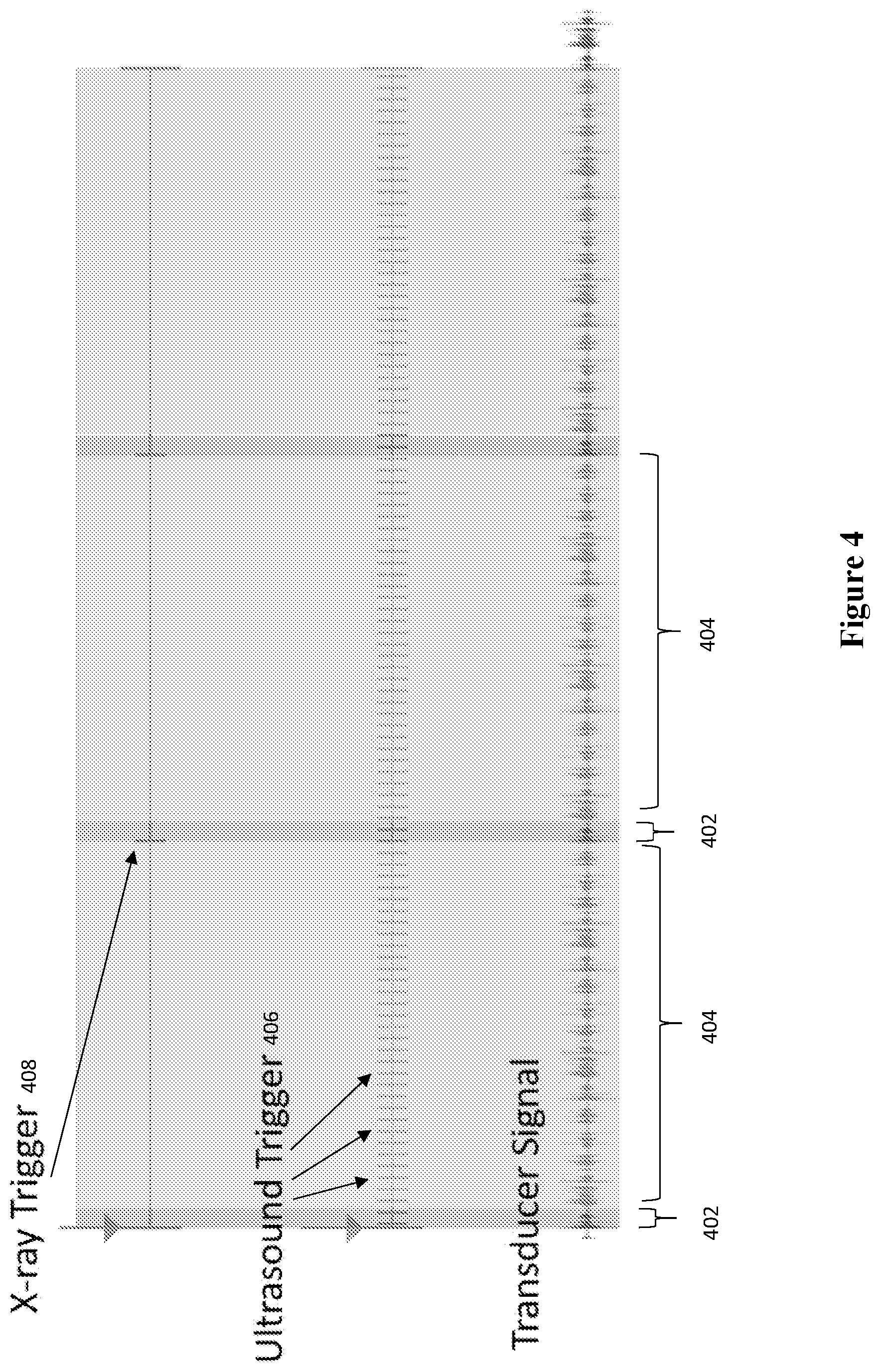 Patent US12611553 Figure 5 – System and method of XACT/US-guided radiotherapy