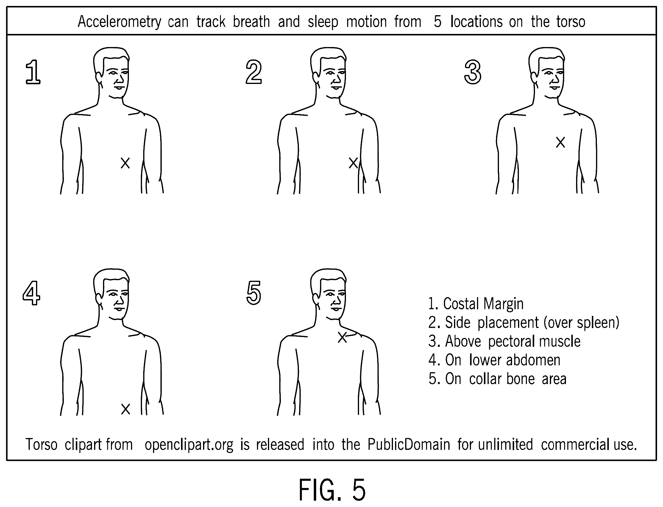 Patent US12611555 Figure 5 – Systems and methods for targeting an organ with ultrasound stimulation for treating inflammation
