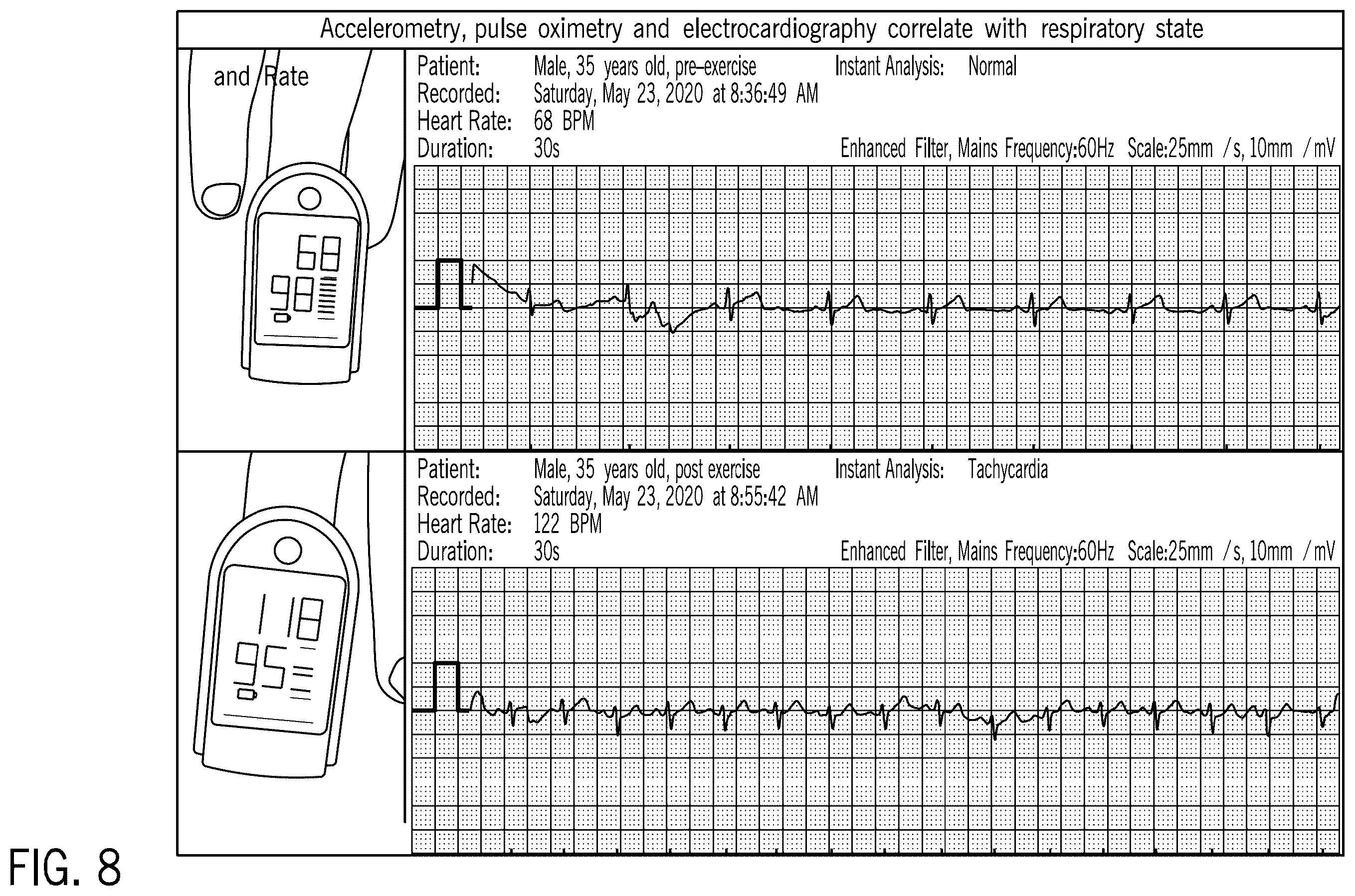 Patent US12611555 Figure 8 – Systems and methods for targeting an organ with ultrasound stimulation for treating inflammation