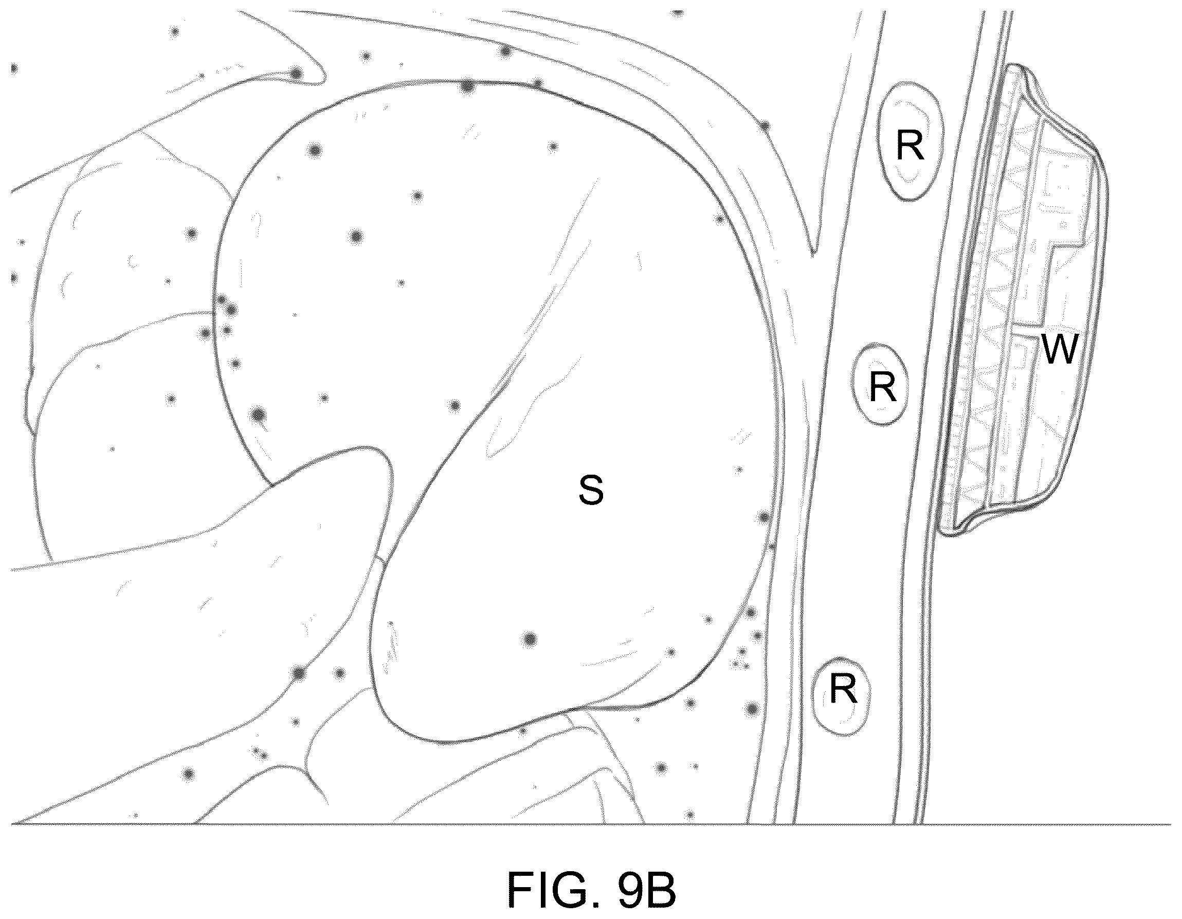 Patent US12611555 Figure 10 – Systems and methods for targeting an organ with ultrasound stimulation for treating inflammation