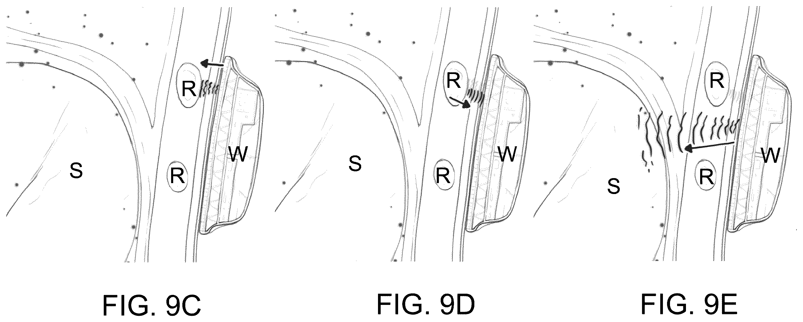 Patent US12611555 Figure 11 – Systems and methods for targeting an organ with ultrasound stimulation for treating inflammation