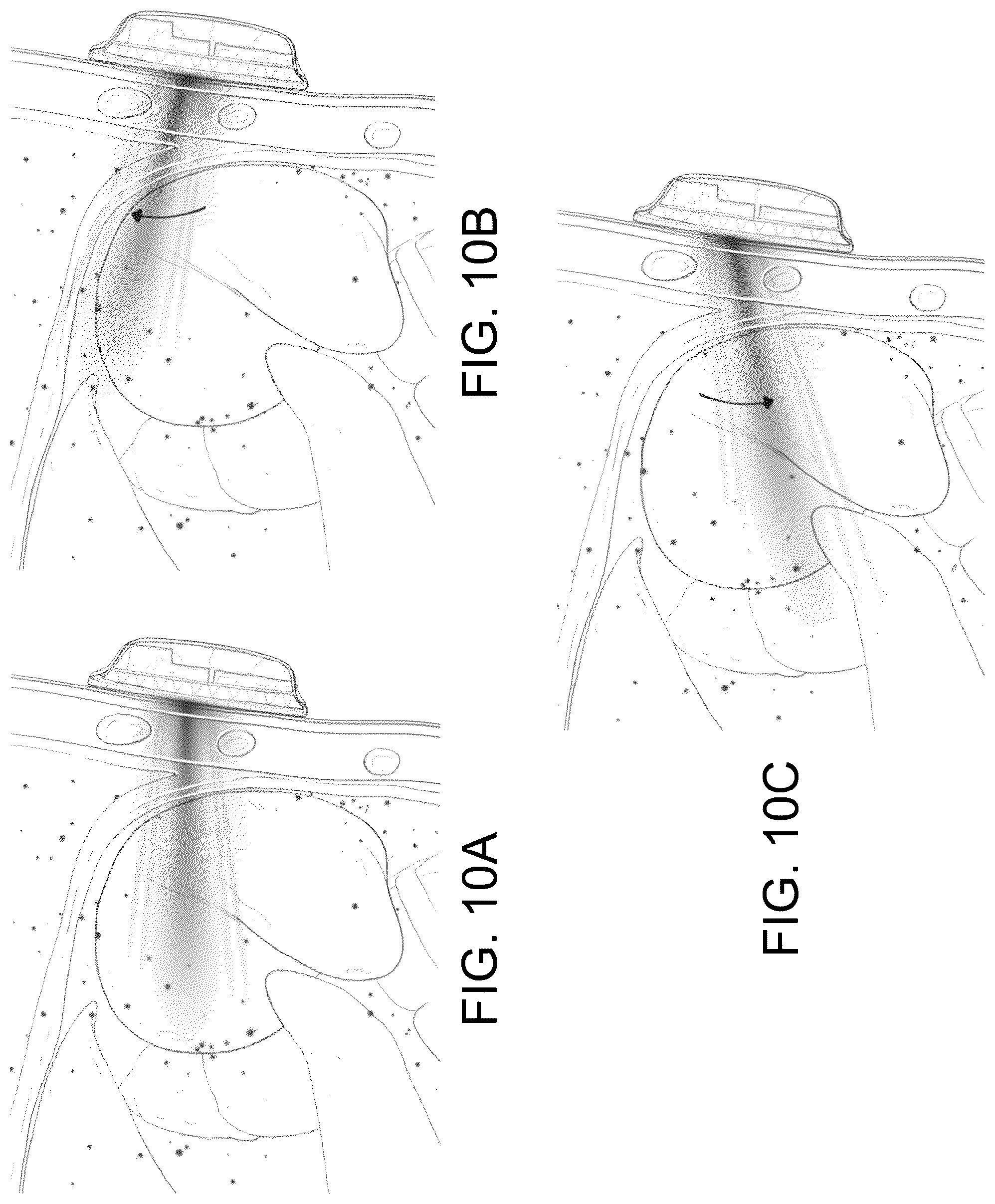 Patent US12611555 Figure 12 – Systems and methods for targeting an organ with ultrasound stimulation for treating inflammation