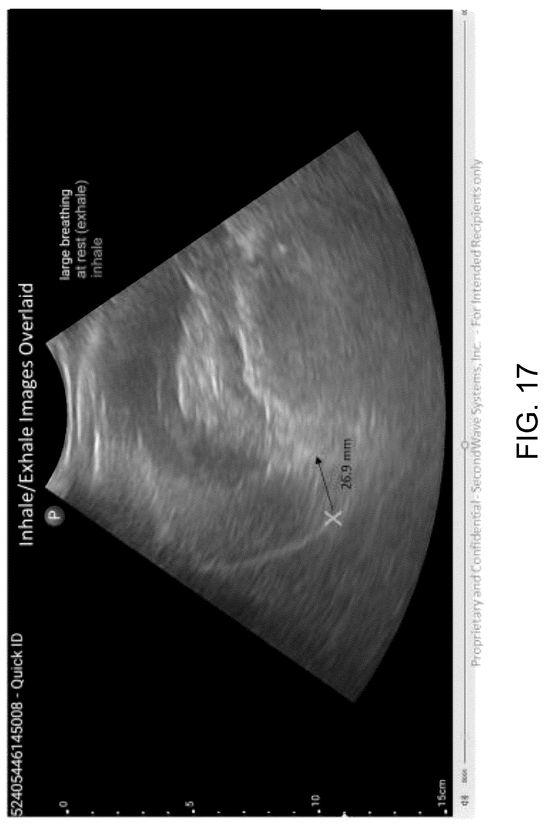 Patent US12611555 Figure 19 – Systems and methods for targeting an organ with ultrasound stimulation for treating inflammation