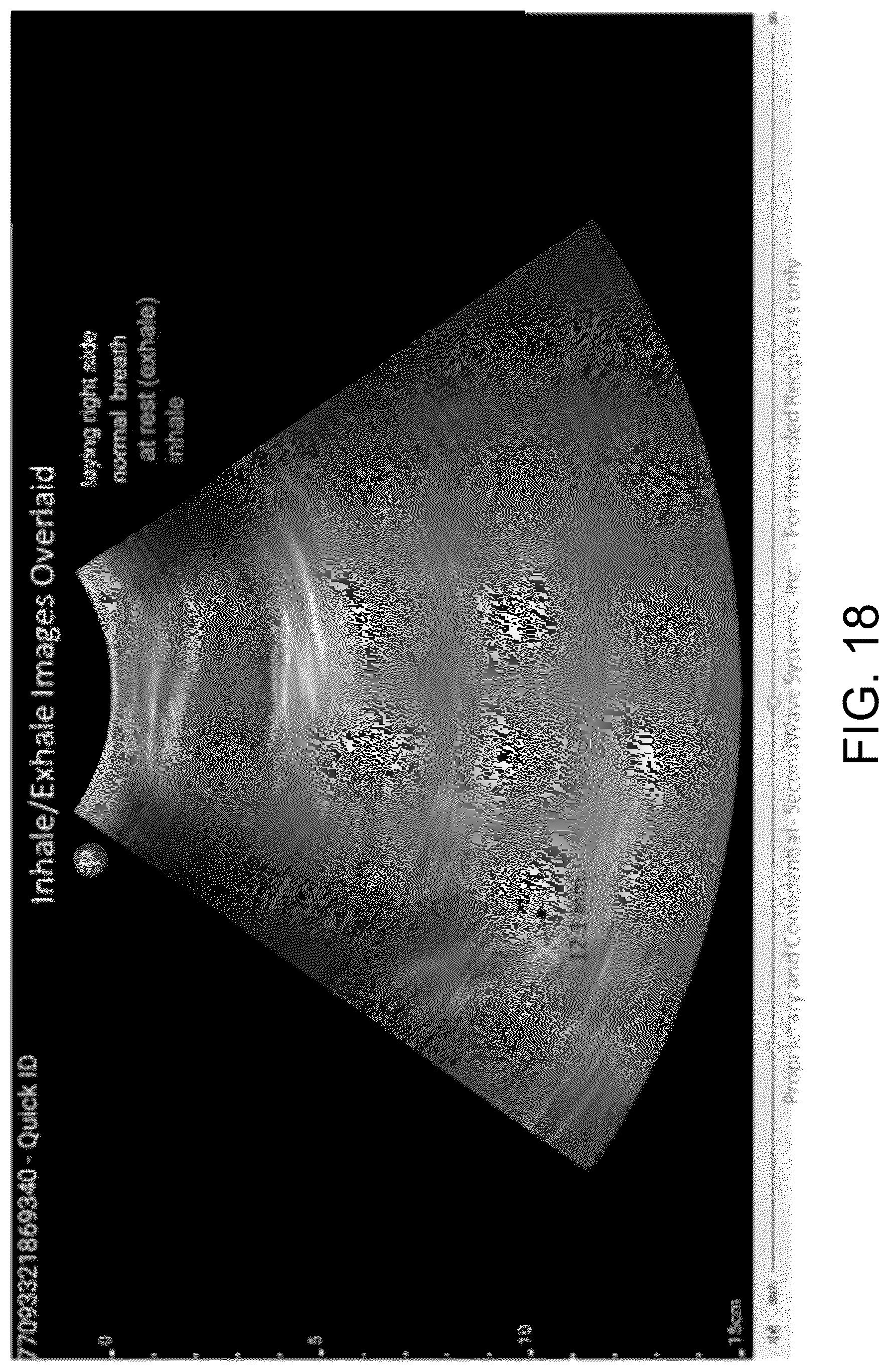 Patent US12611555 Figure 20 – Systems and methods for targeting an organ with ultrasound stimulation for treating inflammation