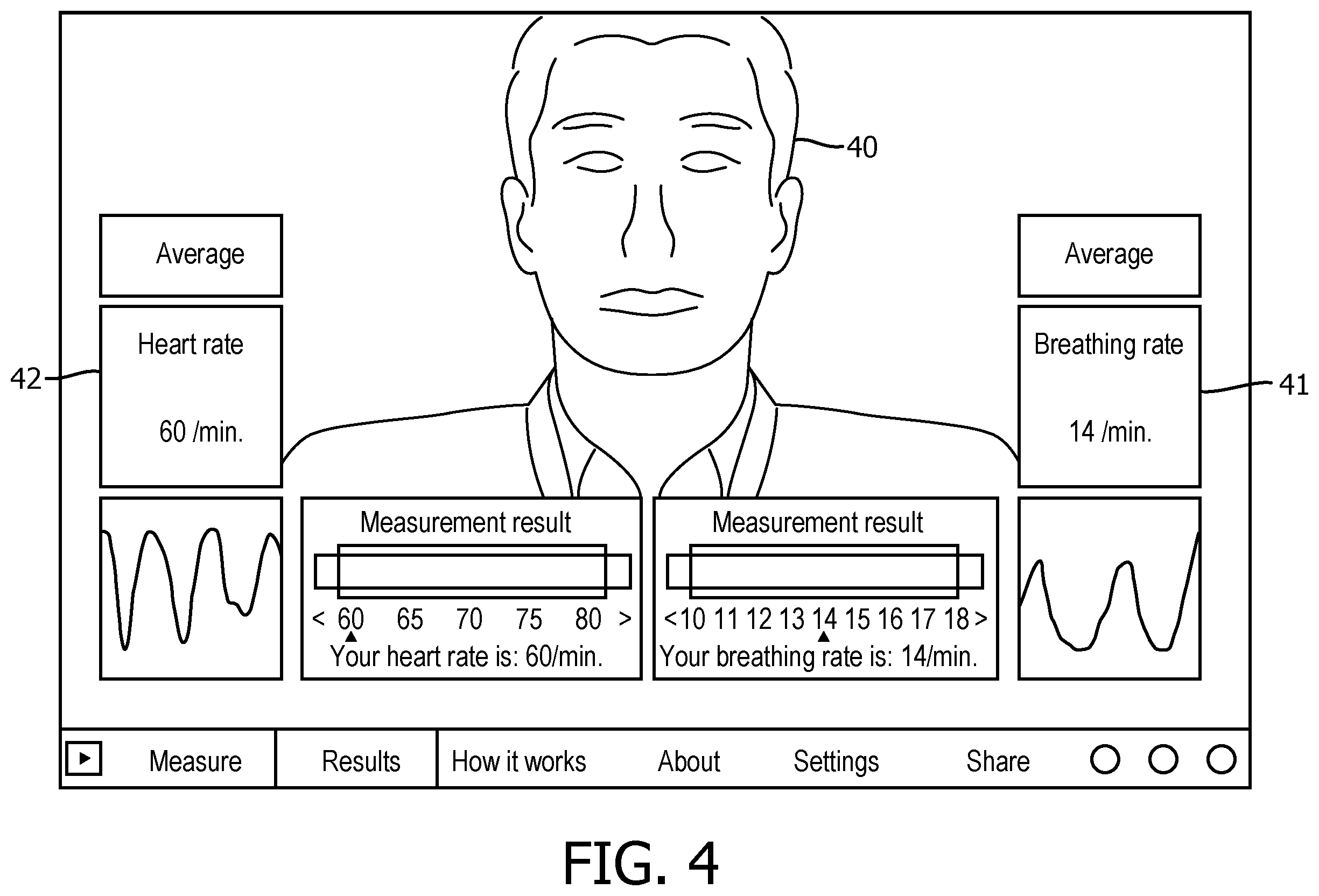 Patent US12611584 Figure 4 – System and method for client-side physiological condition estimations based on a video of an individual