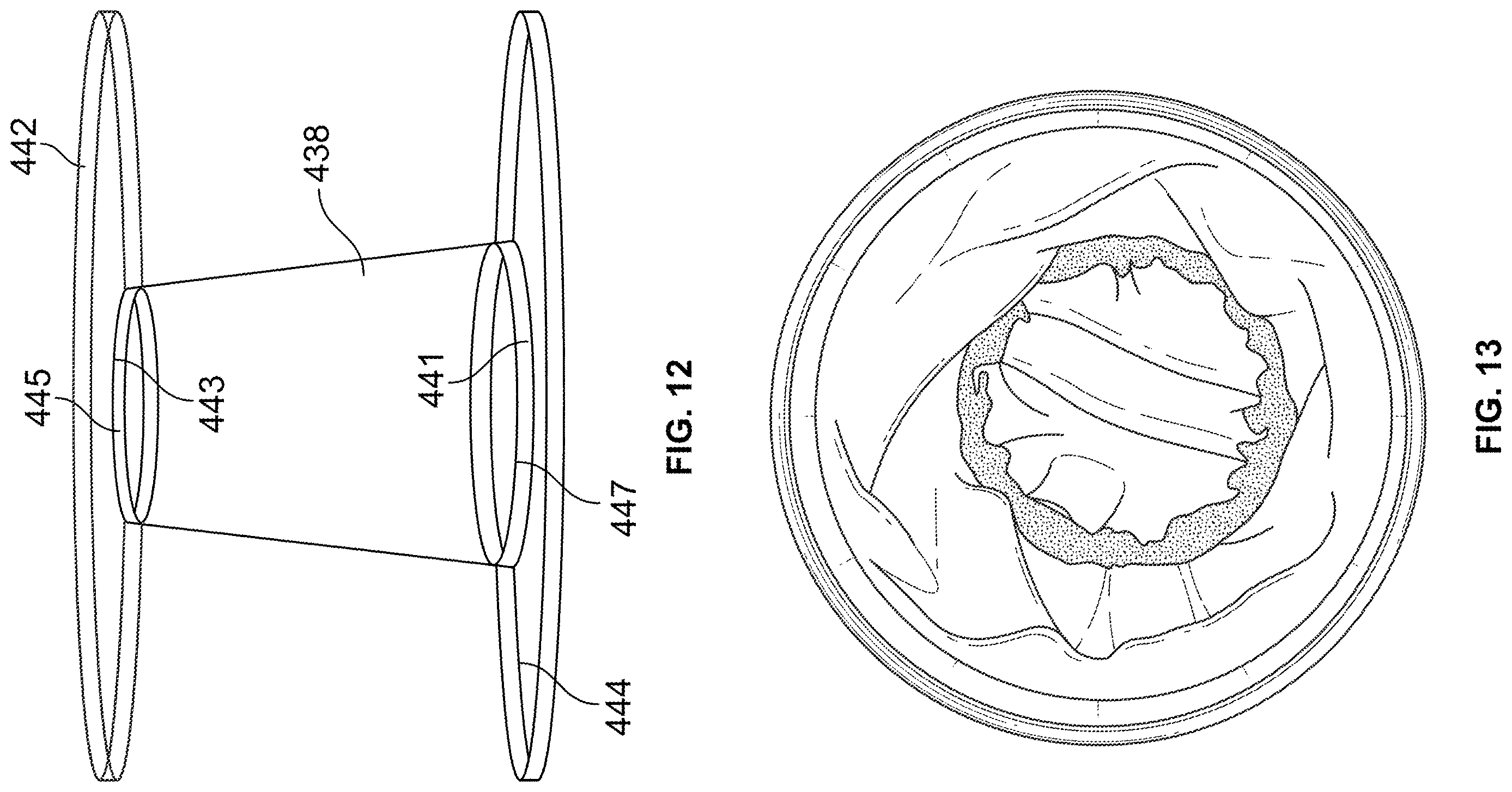 Patent US12611622 Figure 8 – Multistage filter with hydrophobic screen