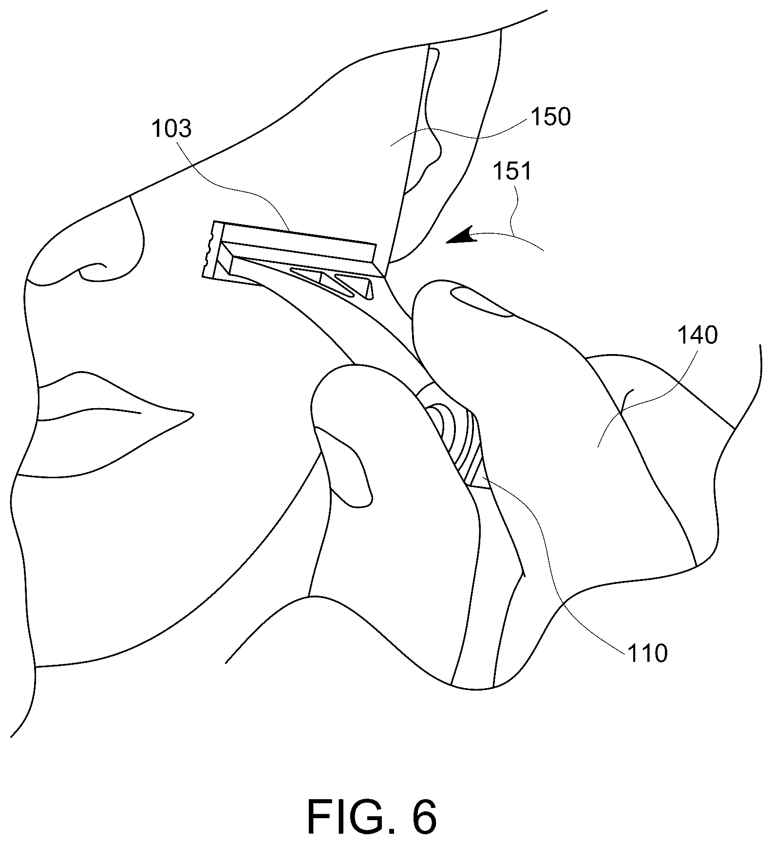 Patent US12611790 Figure 14 – Rotating shaving razor apparatus
