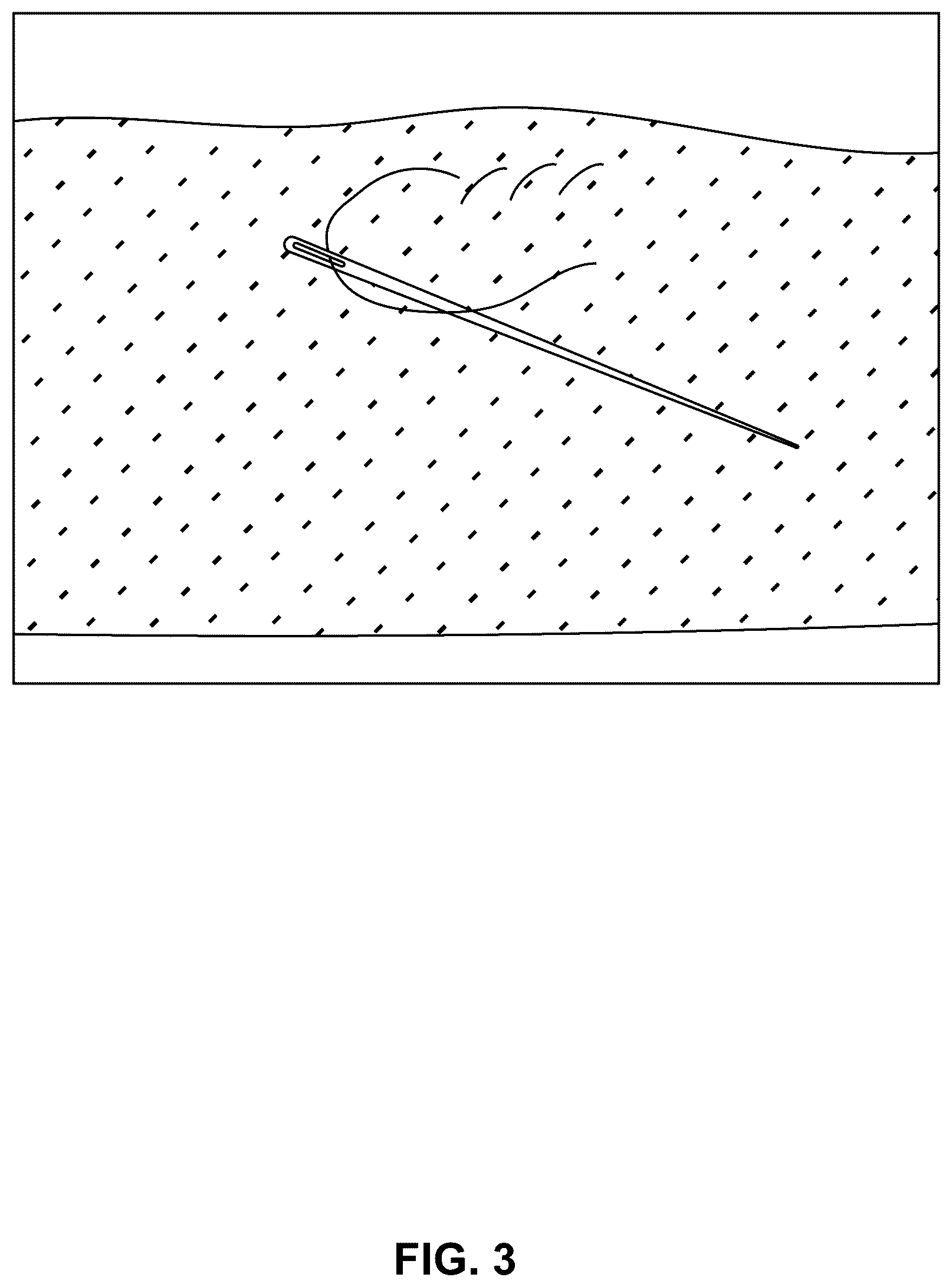 Patent US12611841 Figure 3 – Method for producing regenerated cellulose-based threads and felted cloths