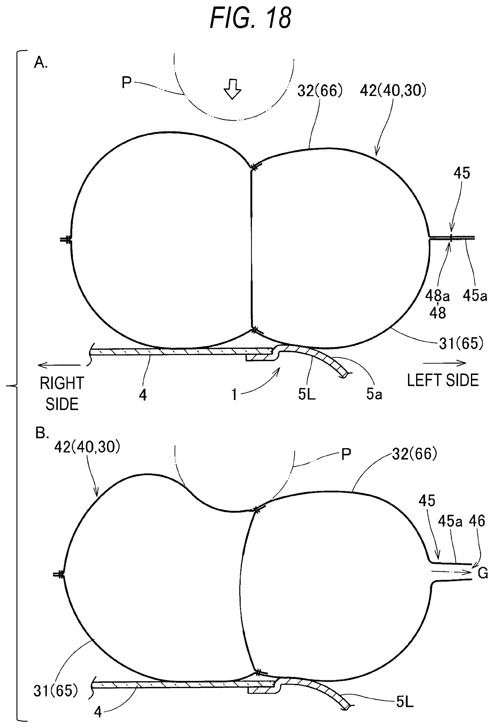 Patent US12612008 Figure 18 – Pedestrian protection airbag and pedestrian airbag device