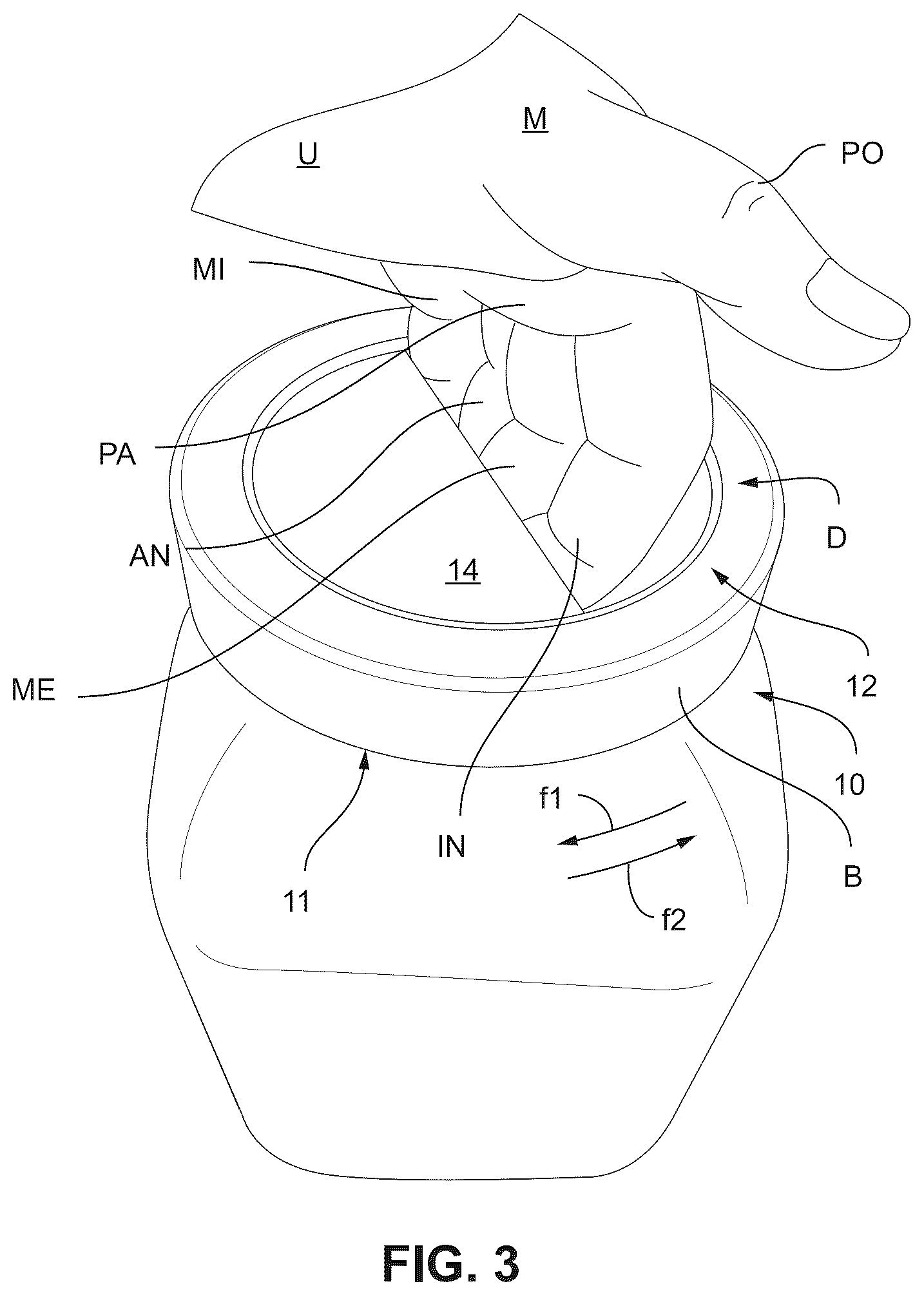 Patent US12612218 Figure 4 – Cover or cap screwable onto a container, in particular of glass, with a manual grip formed by a recess or a bar
