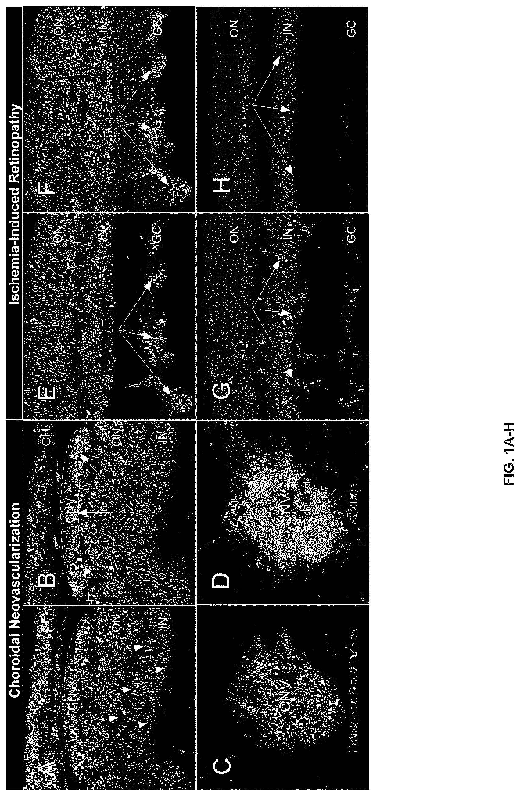 Patent US12612385 Figure 1 – Compounds and methods for targeting pathogenic blood vessels
