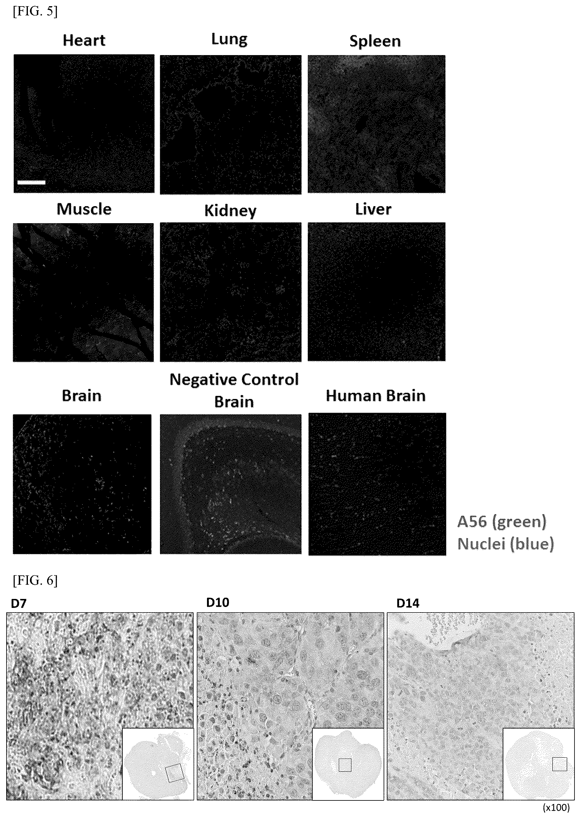 Patent US12612448 Figure 4 – Tumor-targeting A56 protein or fragment thereof, antibody binding to A56 protein, and use thereof