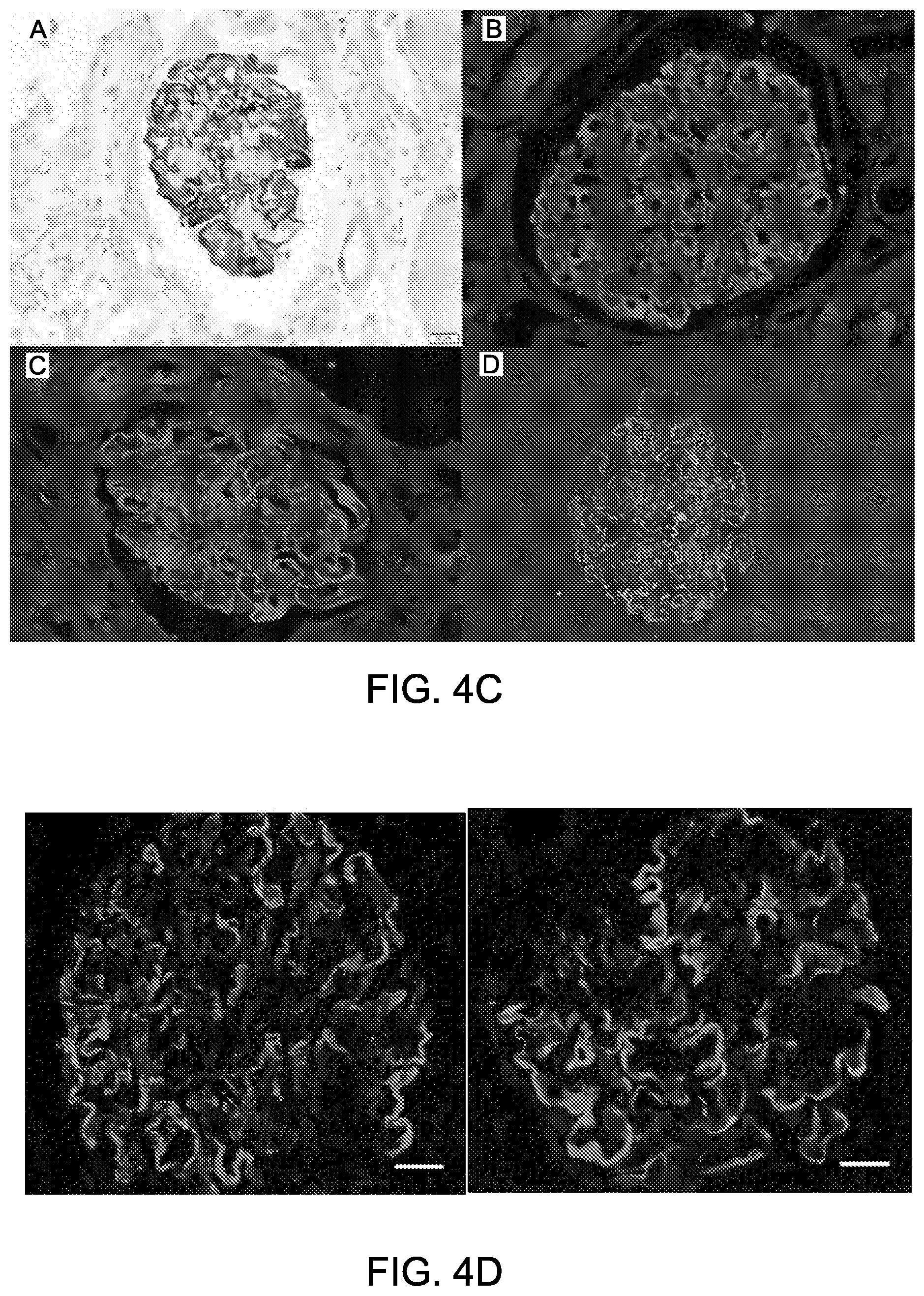 Patent US12612464 Figure 7 – Autoantibody specifically binding to NELL-1 and elevated NELL-1 polypeptide levels for identifying and treating membranous nephropathy