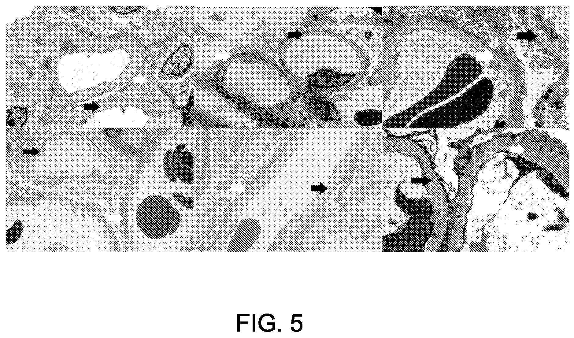 Patent US12612464 Figure 8 – Autoantibody specifically binding to NELL-1 and elevated NELL-1 polypeptide levels for identifying and treating membranous nephropathy