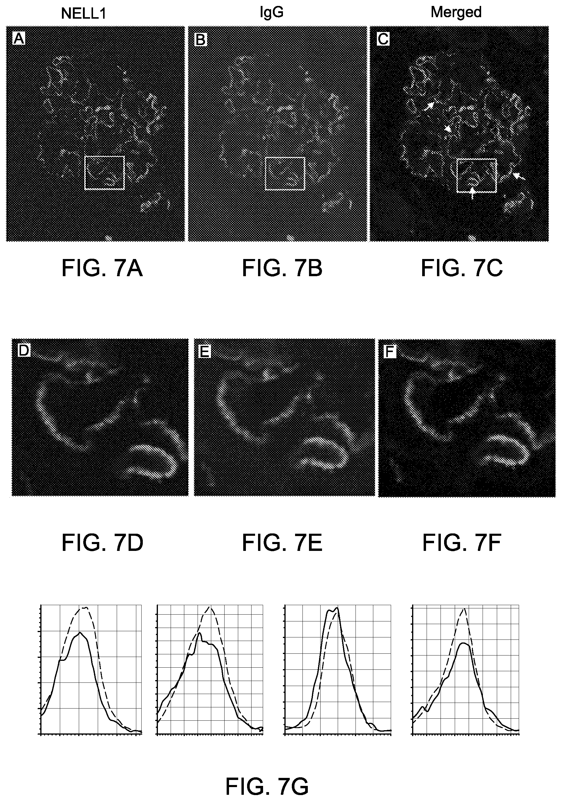 Patent US12612464 Figure 11 – Autoantibody specifically binding to NELL-1 and elevated NELL-1 polypeptide levels for identifying and treating membranous nephropathy