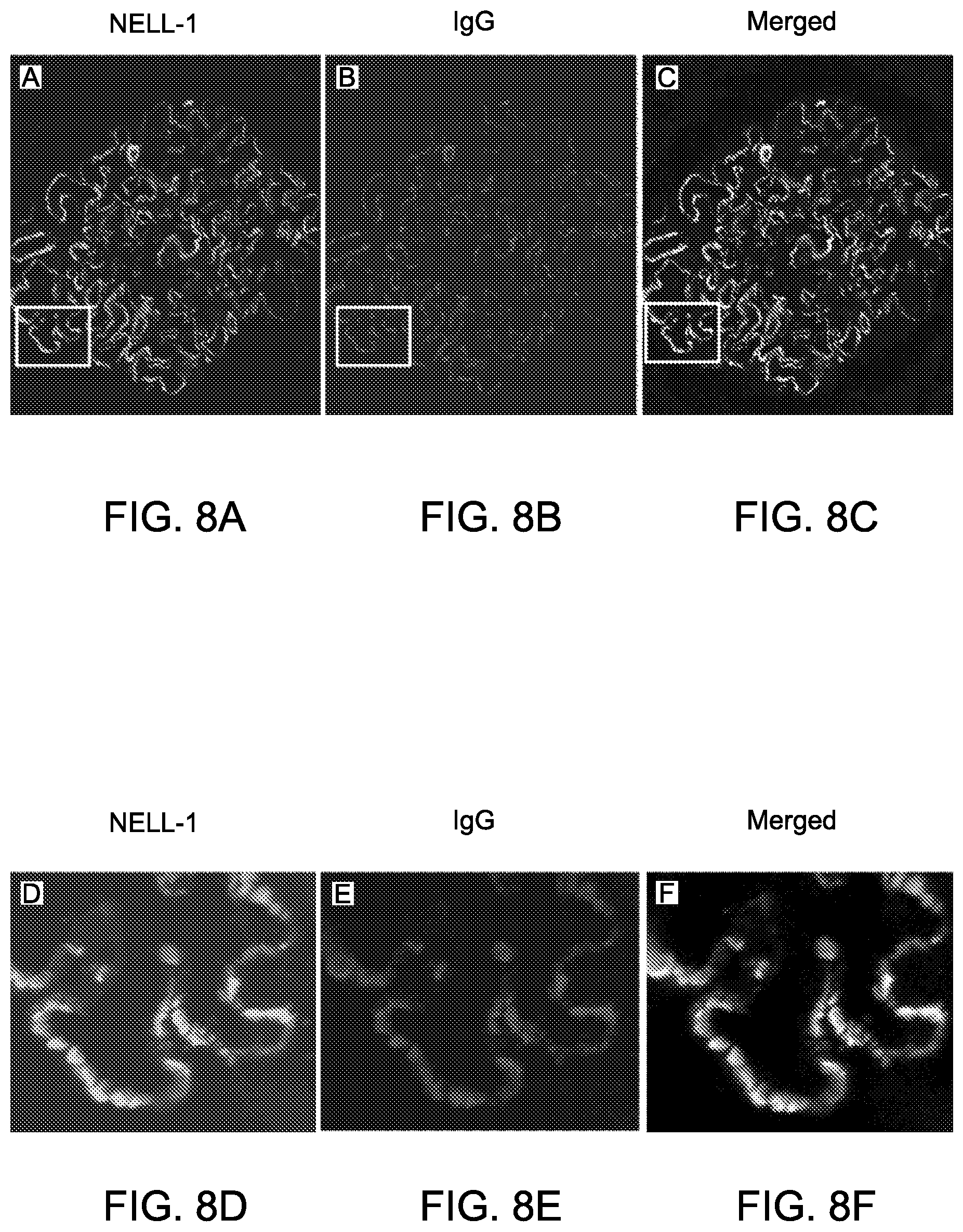 Patent US12612464 Figure 12 – Autoantibody specifically binding to NELL-1 and elevated NELL-1 polypeptide levels for identifying and treating membranous nephropathy