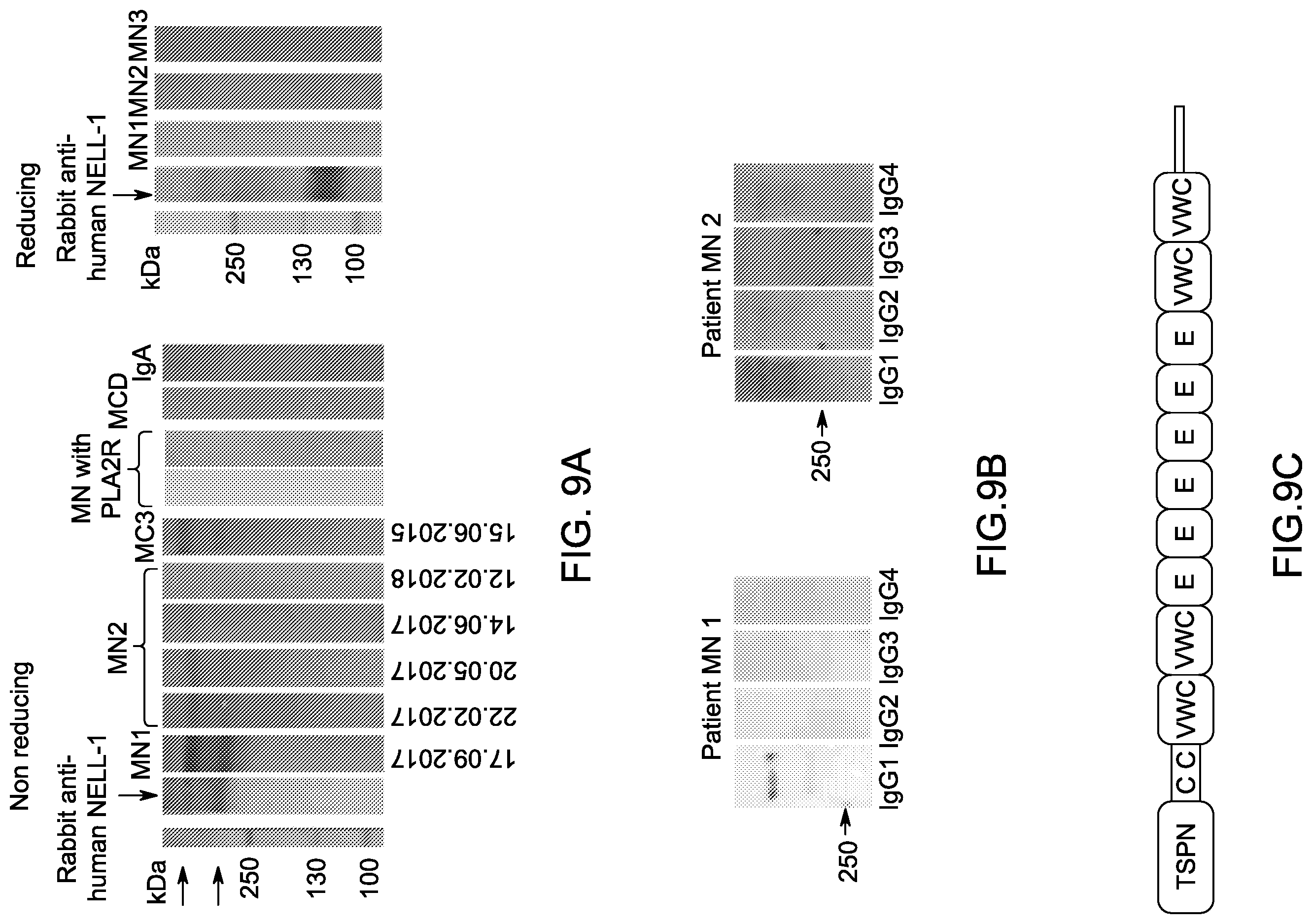 Patent US12612464 Figure 13 – Autoantibody specifically binding to NELL-1 and elevated NELL-1 polypeptide levels for identifying and treating membranous nephropathy