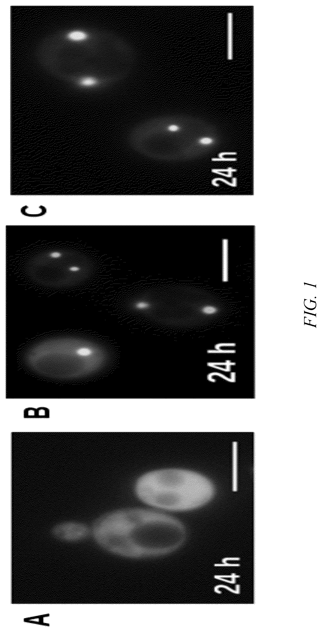 Patent US12612595 Figure 1 – Method for forming reversible membraneless organelle in microorganisms