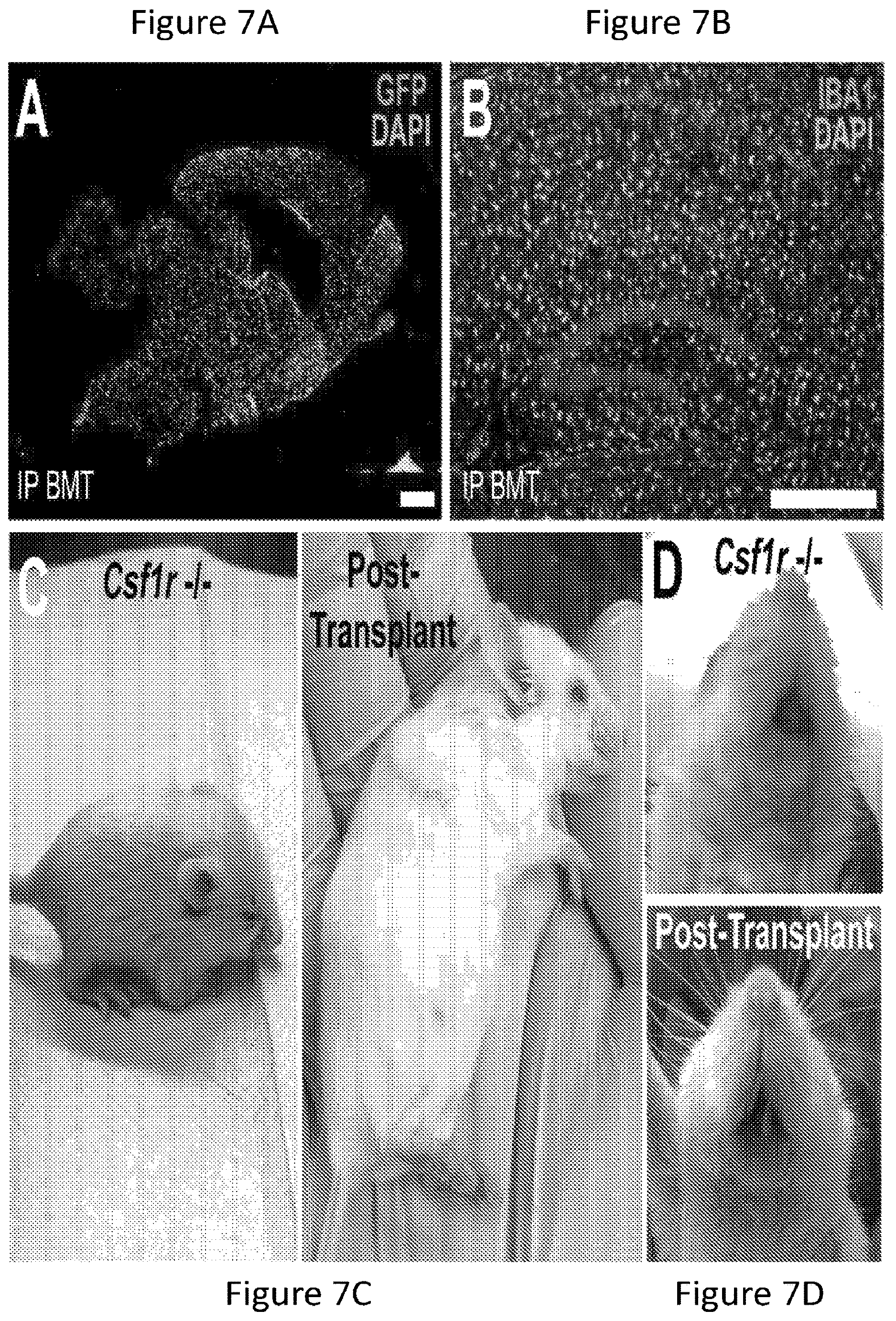 Patent US12612599 Figure 19 – Compositions and methods for microglia replacement therapy
