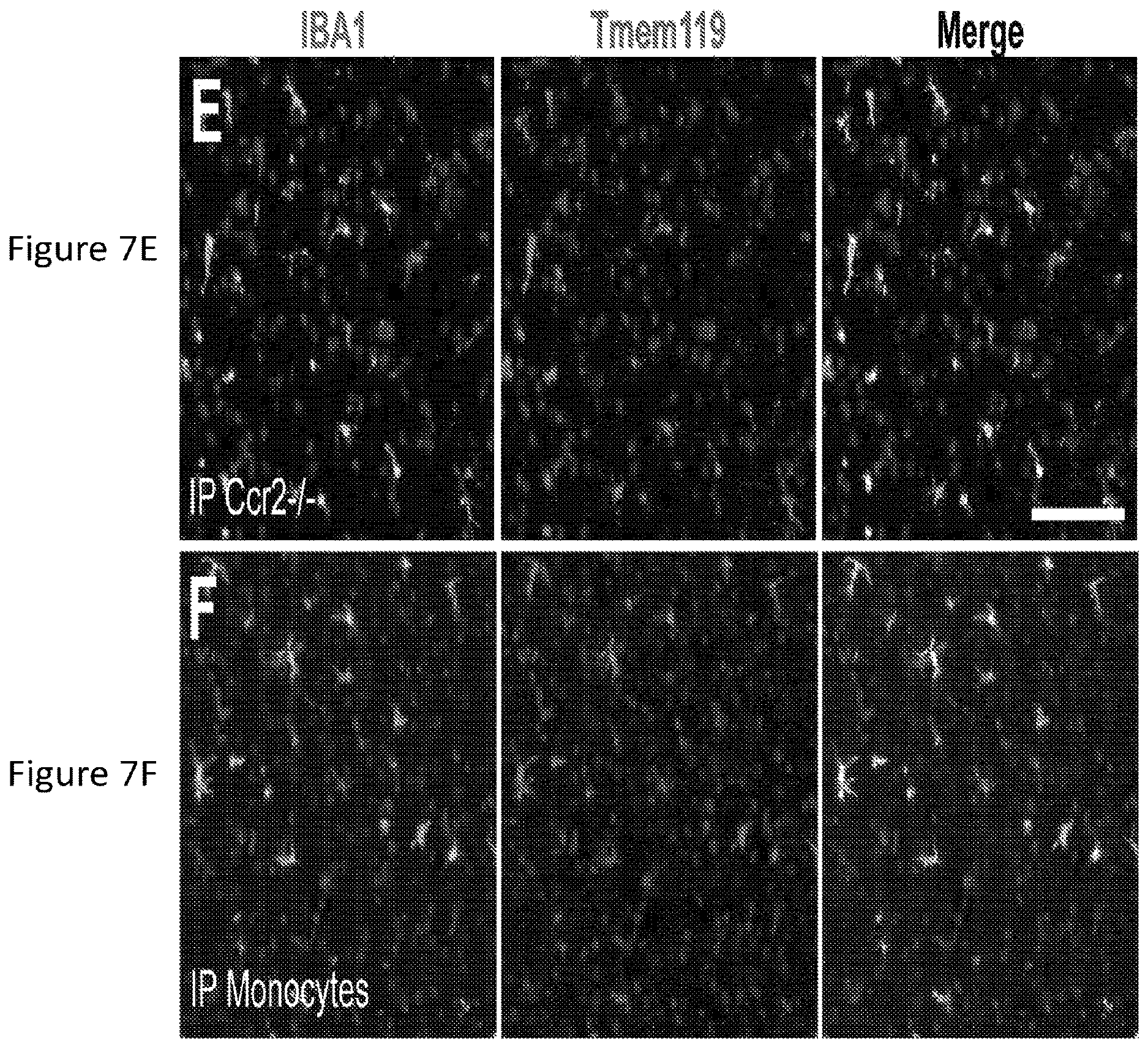Patent US12612599 Figure 20 – Compositions and methods for microglia replacement therapy