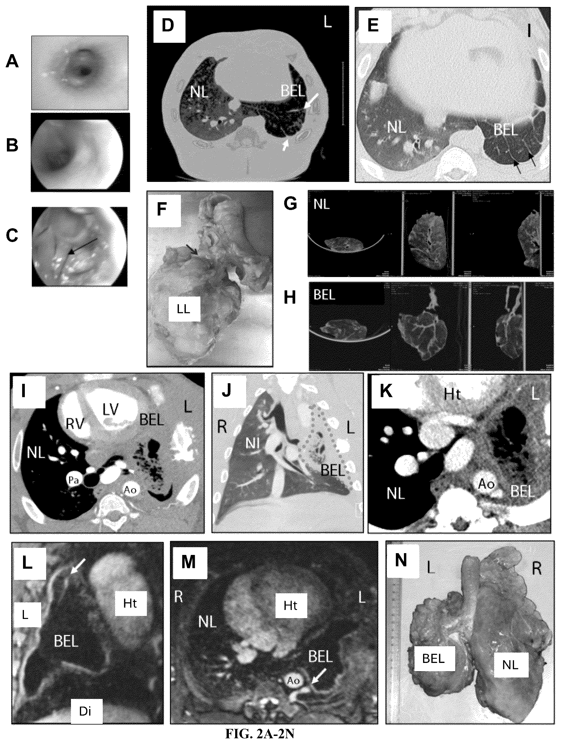 Patent US12612602 Figure 2 – Production of a bioengineered lung
