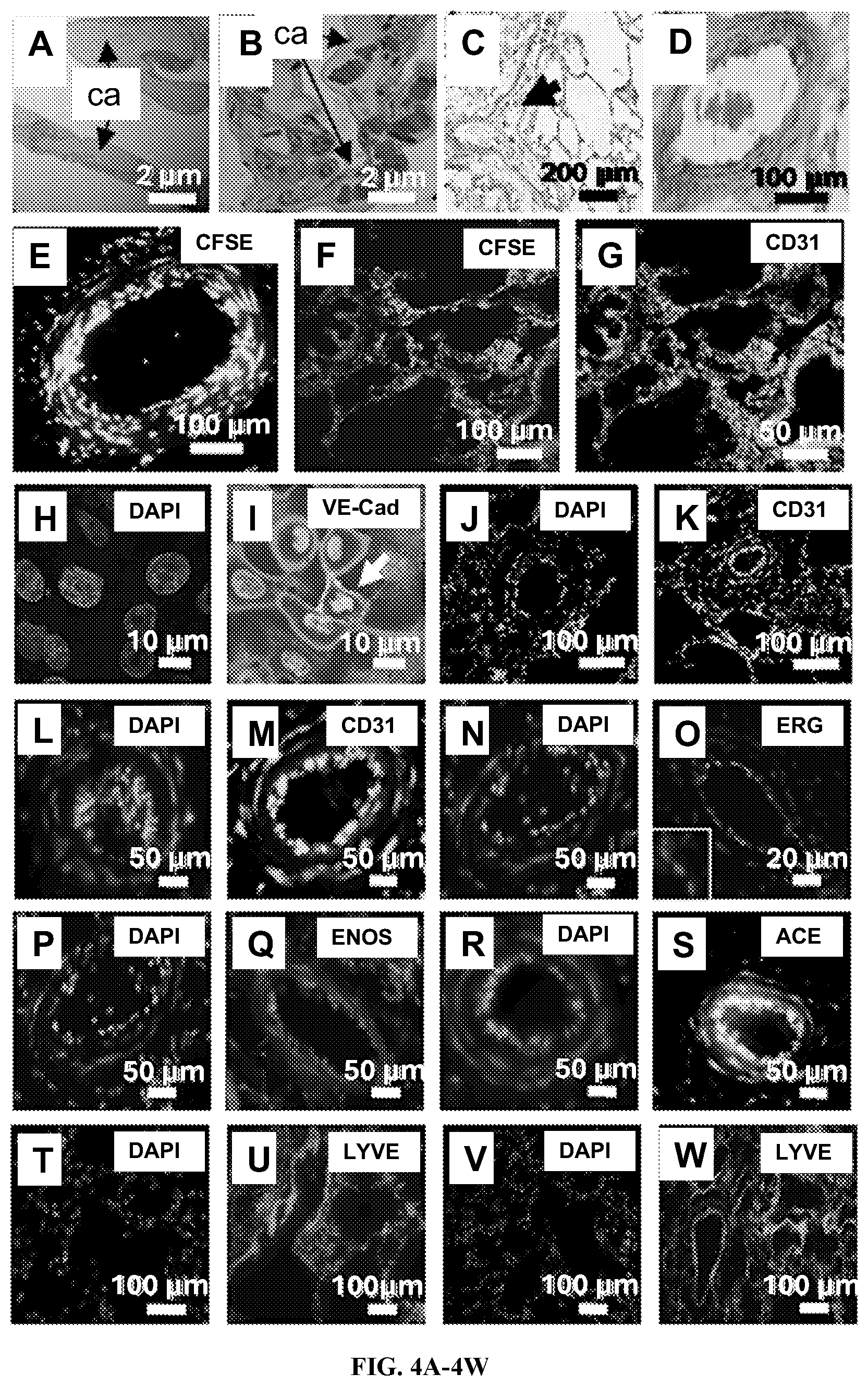 Patent US12612602 Figure 4 – Production of a bioengineered lung