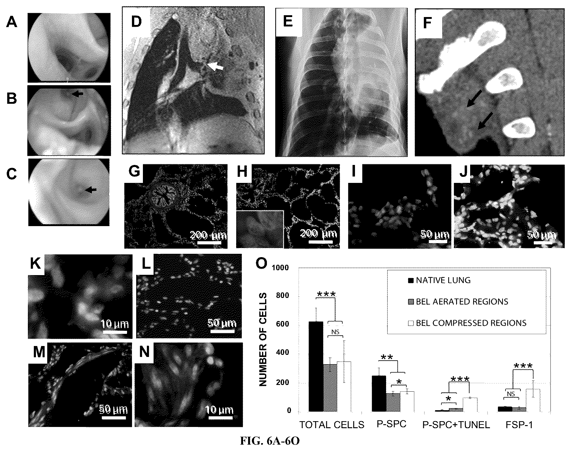 Patent US12612602 Figure 6 – Production of a bioengineered lung