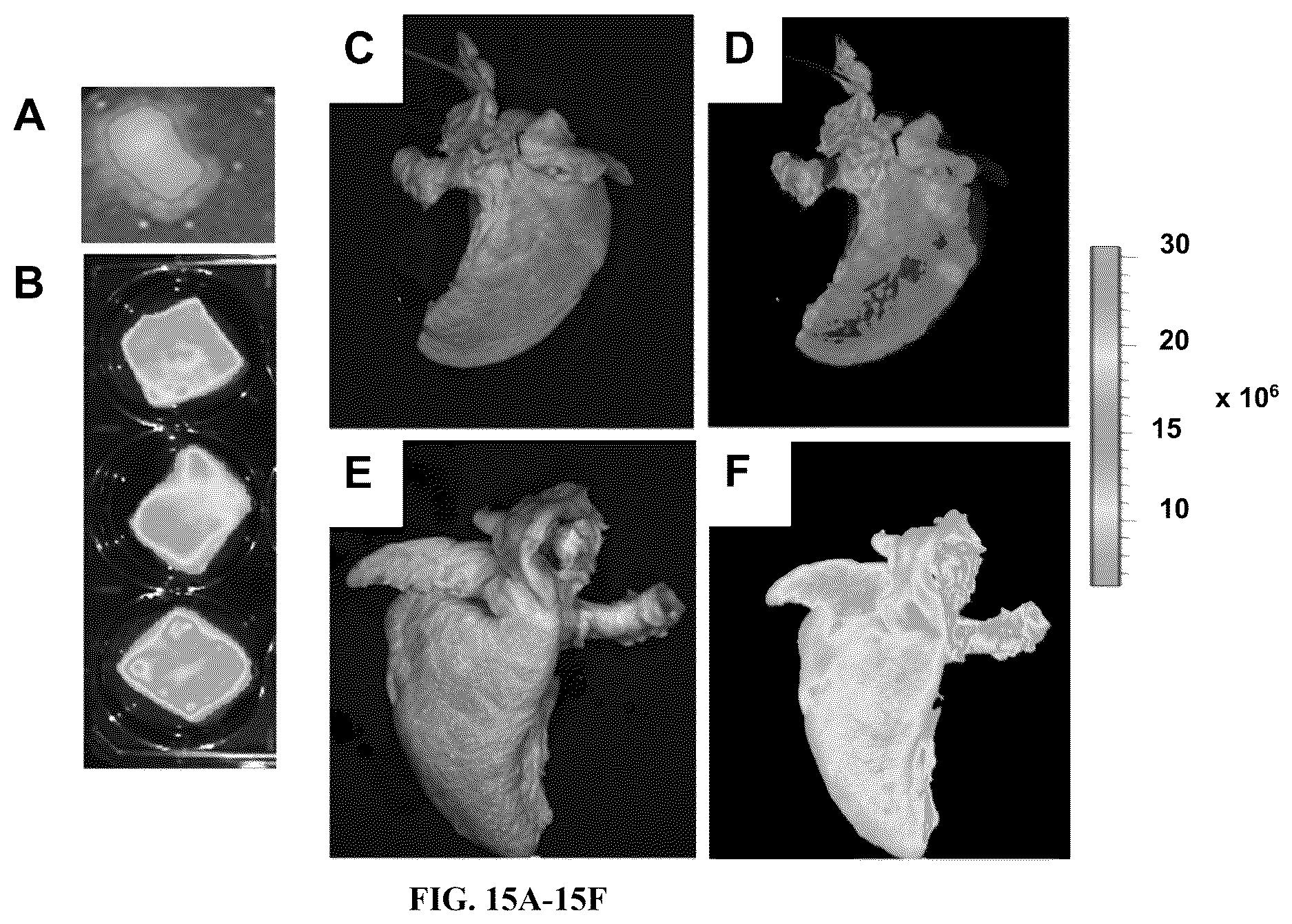 Patent US12612602 Figure 15 – Production of a bioengineered lung