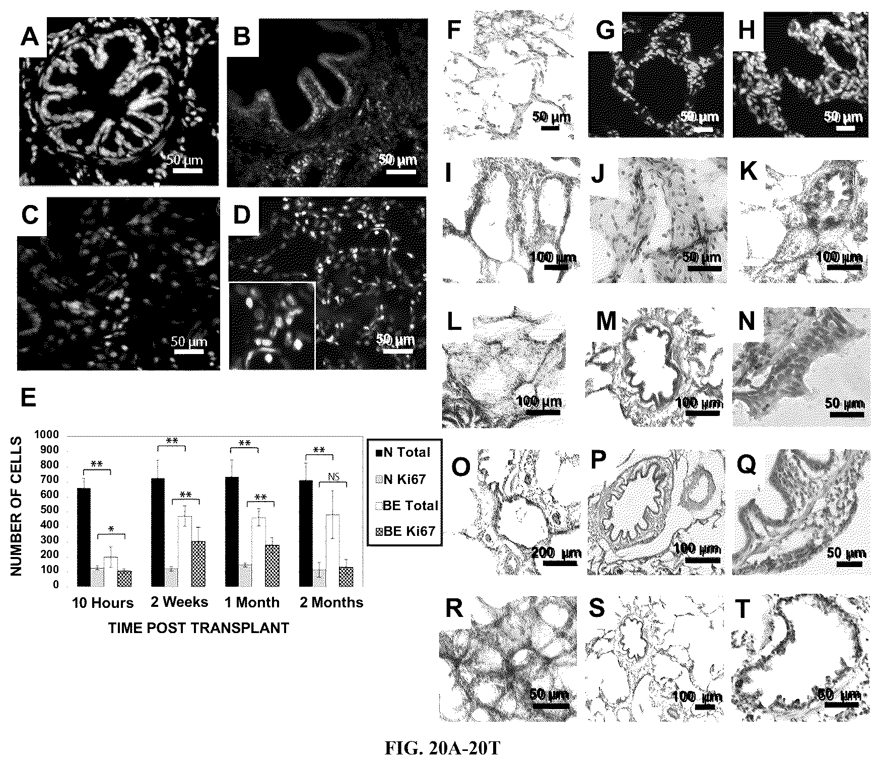 Patent US12612602 Figure 20 – Production of a bioengineered lung
