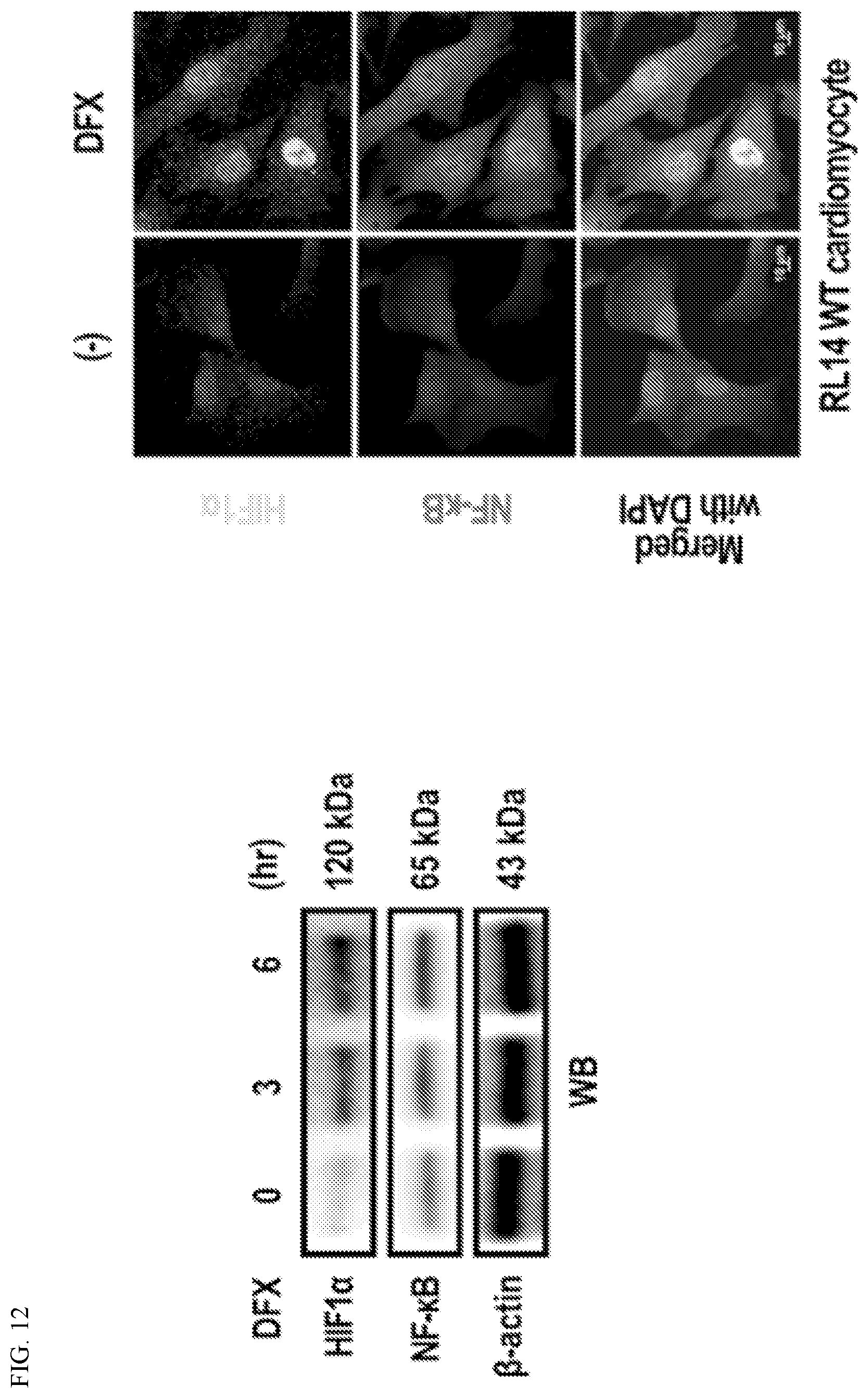 Patent US12612627 Figure 12 – Compositions and methods for increasing sodium current in cardiac cells