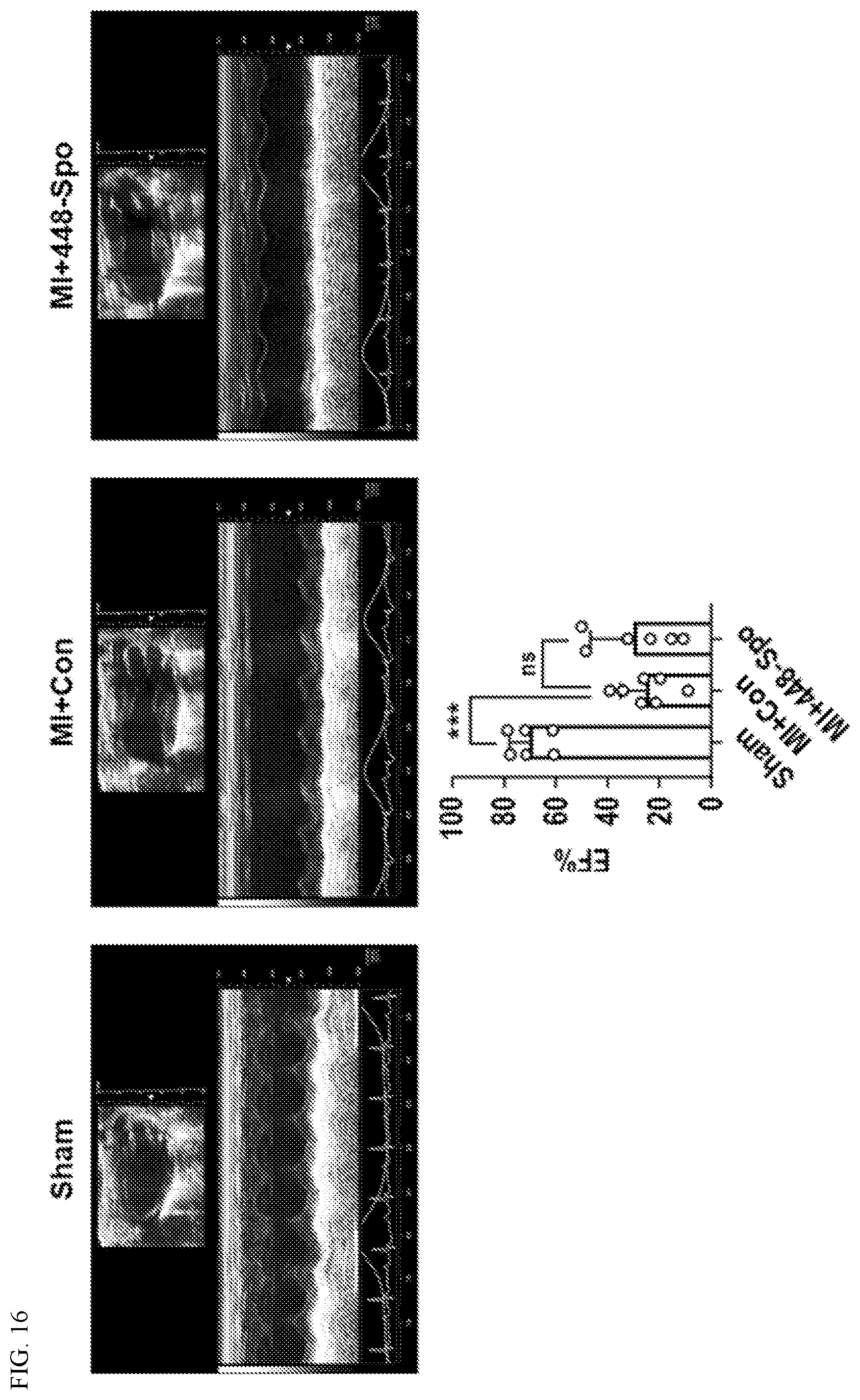 Patent US12612627 Figure 16 – Compositions and methods for increasing sodium current in cardiac cells