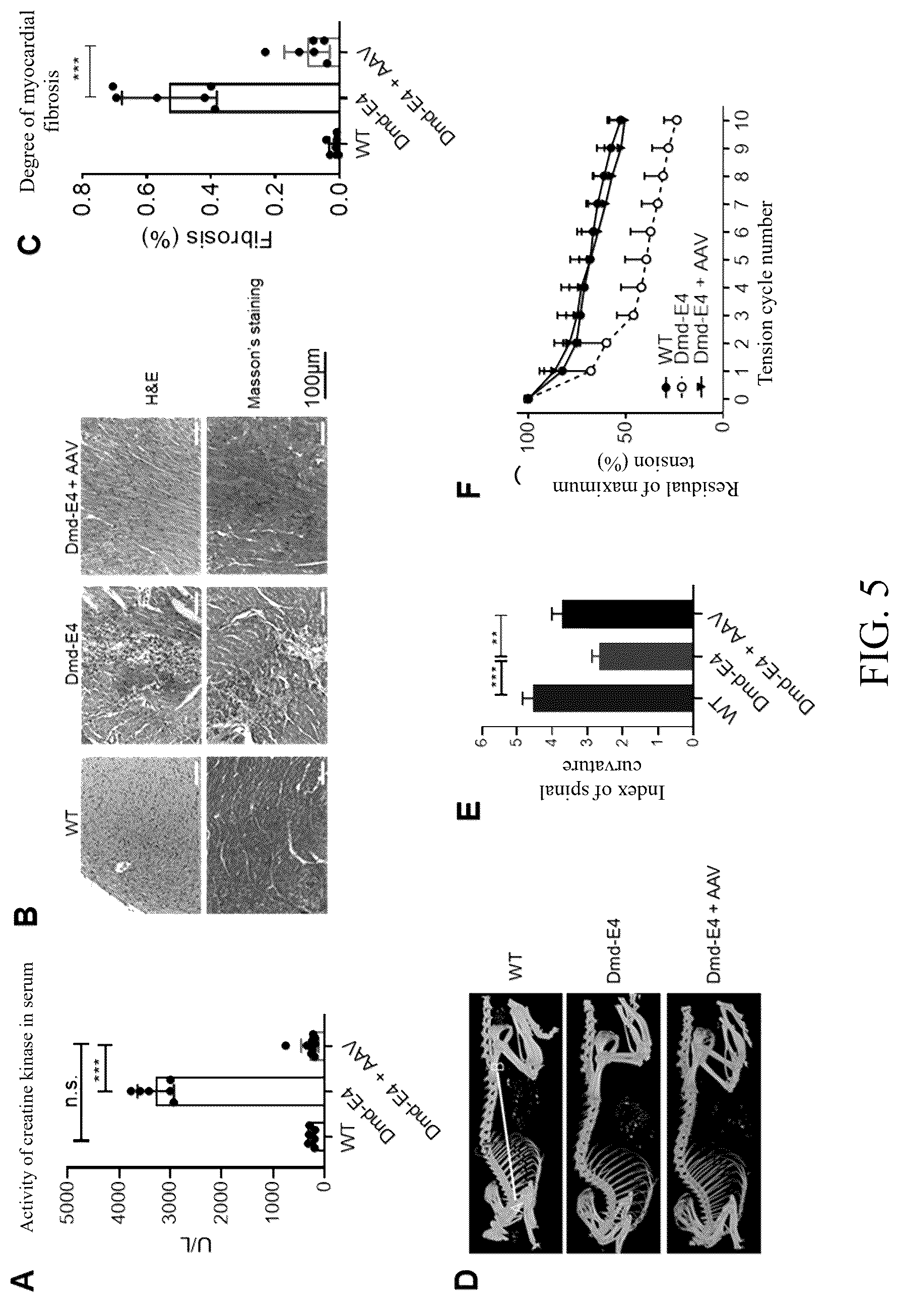 Patent US12612629 Figure 6 – Duchenne muscular dystrophy-related exonic splicing enhancer, sgRNA and gene editing tool, and applications