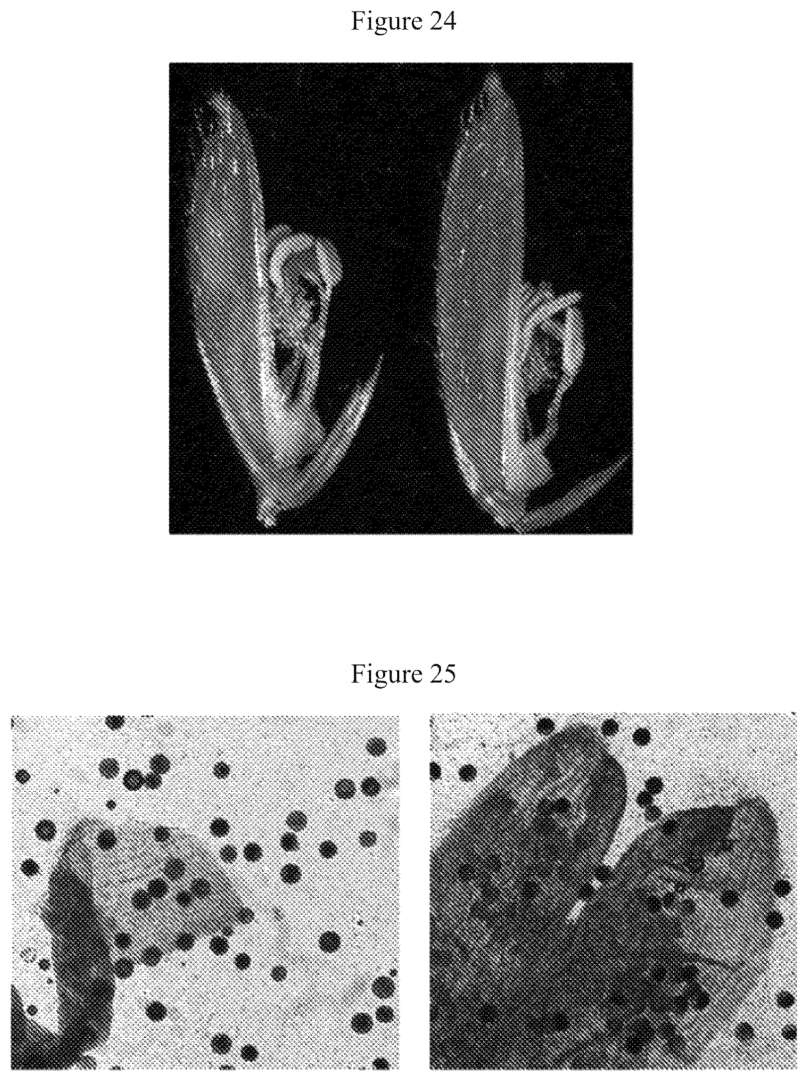 Patent US12612641 Figure 11 – Rice male fertility regulatory gene, mutant of rice male fertility regulatory gene, use thereof and a method for regulating rice fertility