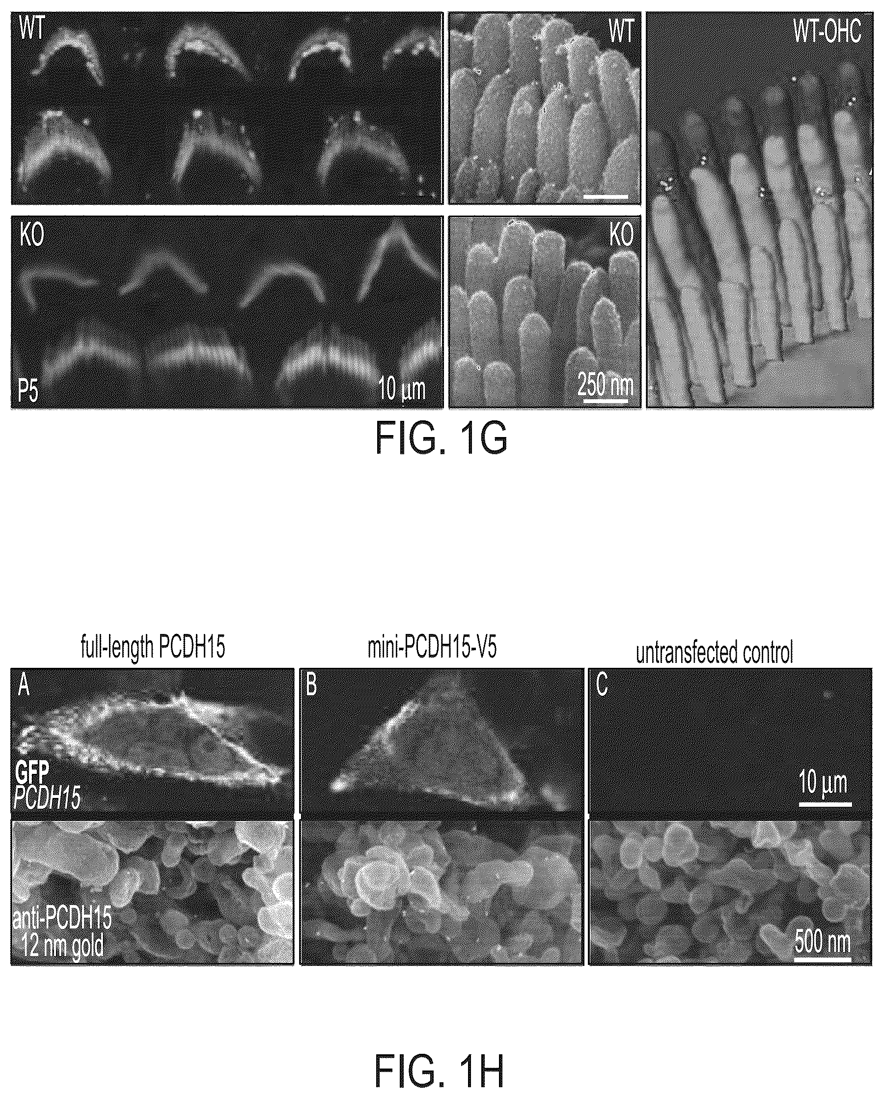 Patent US12612645 Figure 4 – AAV vectors encoding mini-PCDH15 and uses thereof