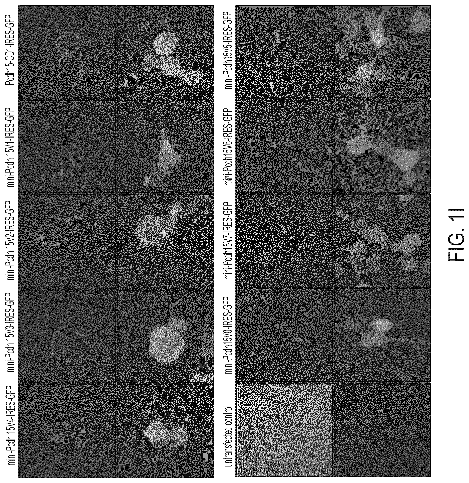 Patent US12612645 Figure 5 – AAV vectors encoding mini-PCDH15 and uses thereof